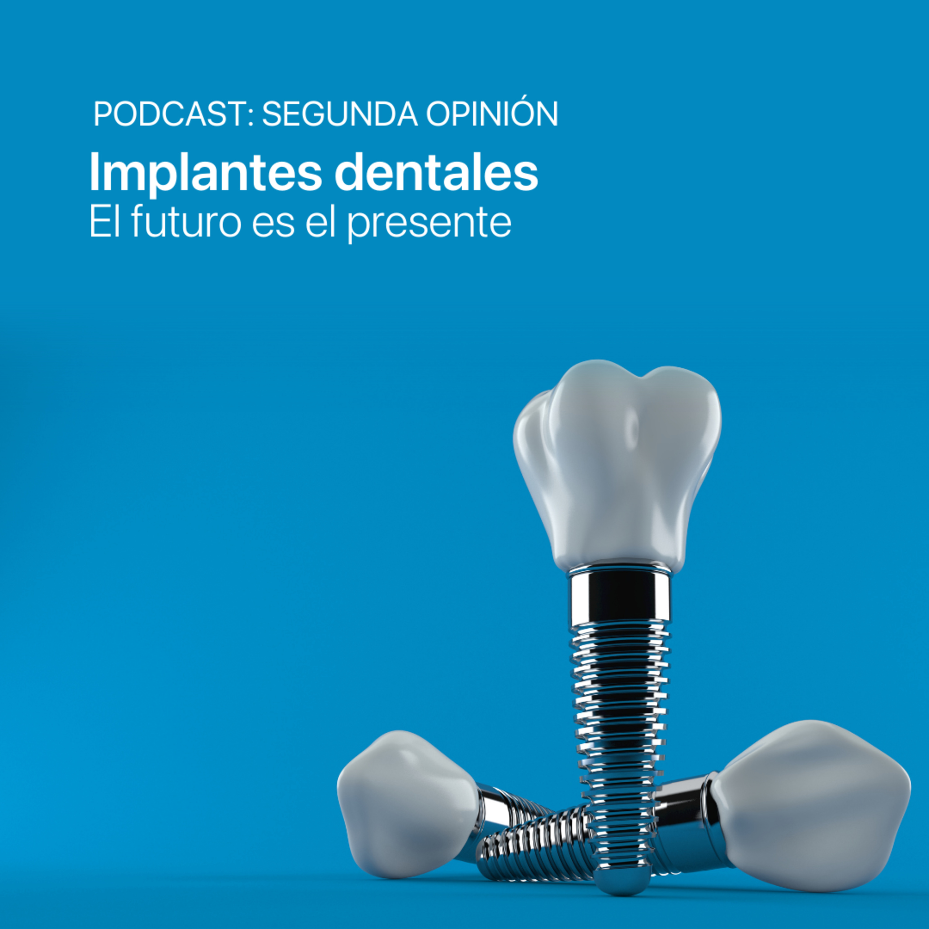 Segunda Opinión