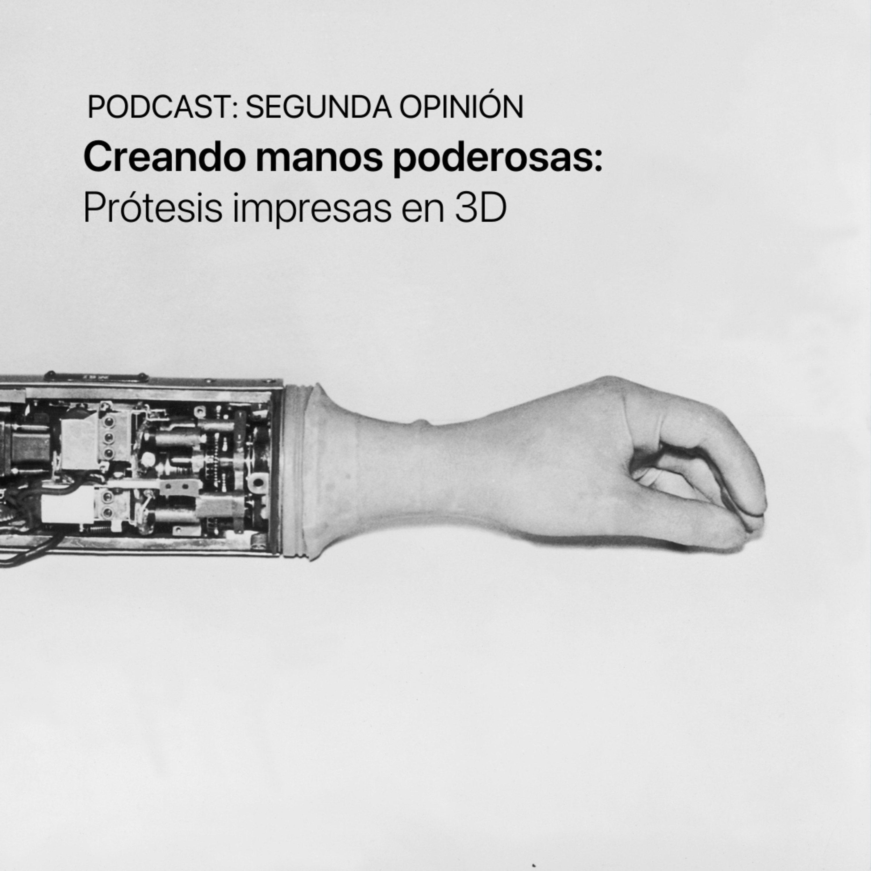 Segunda Opinión