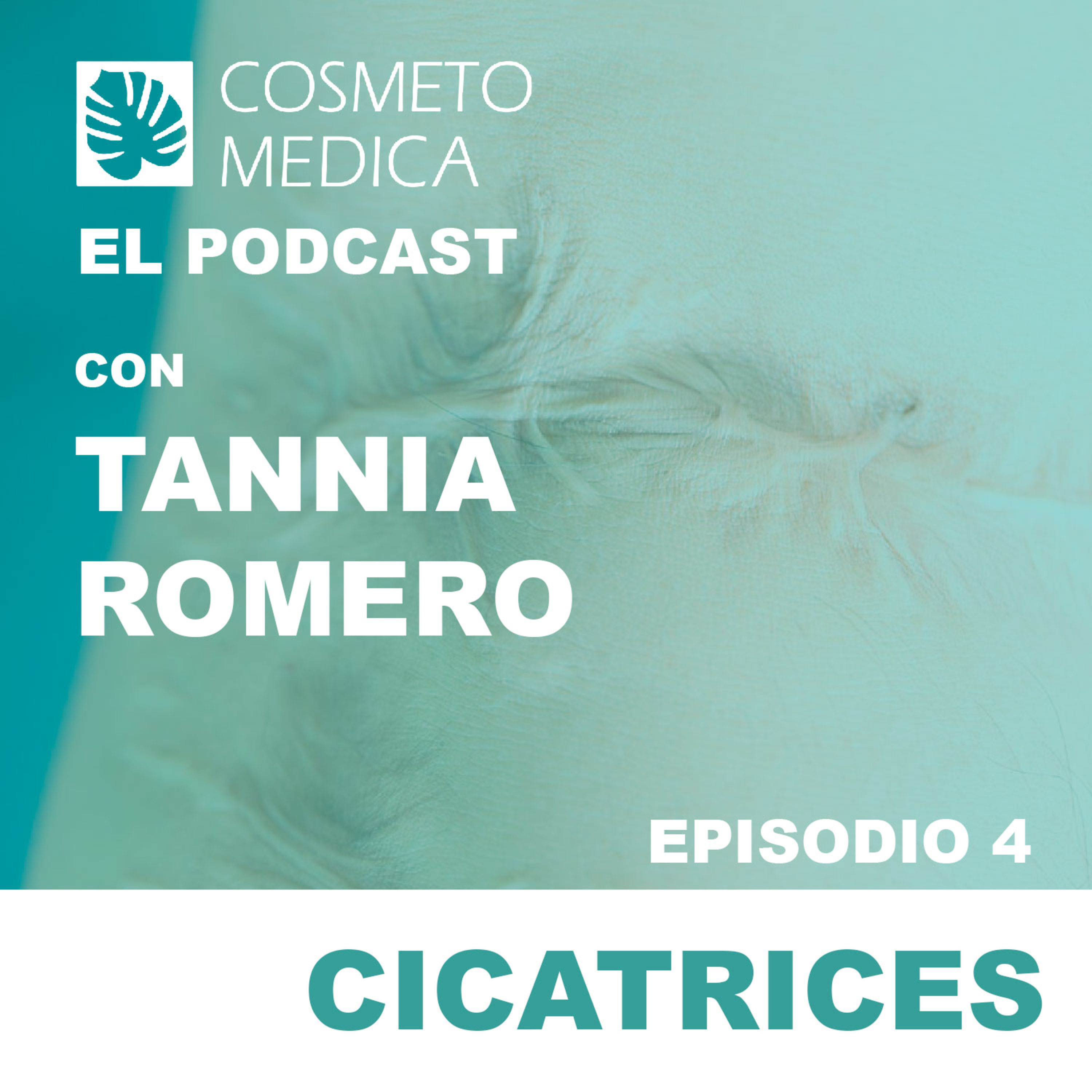 Cicatrices episode artwork