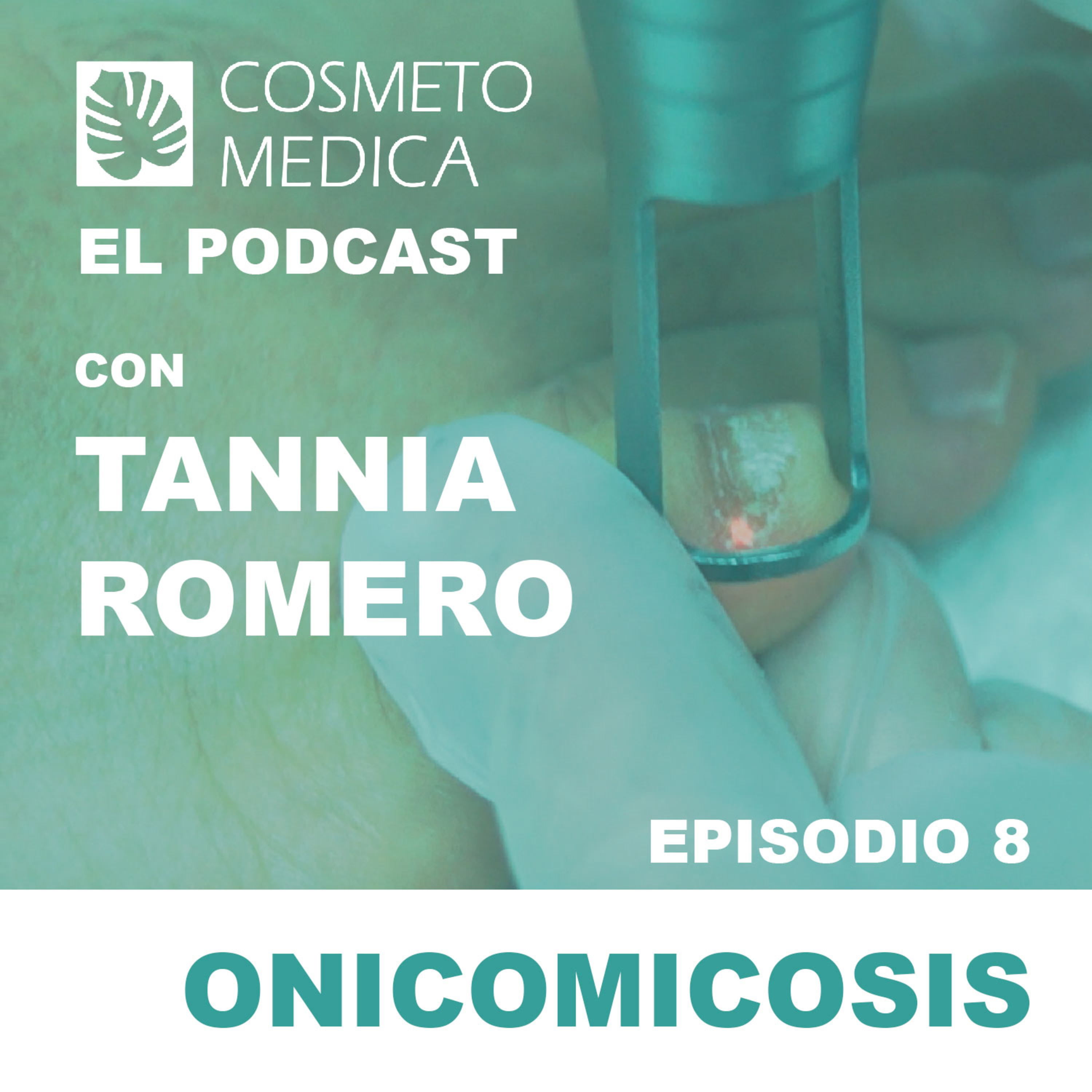 Onicomicosis episode artwork