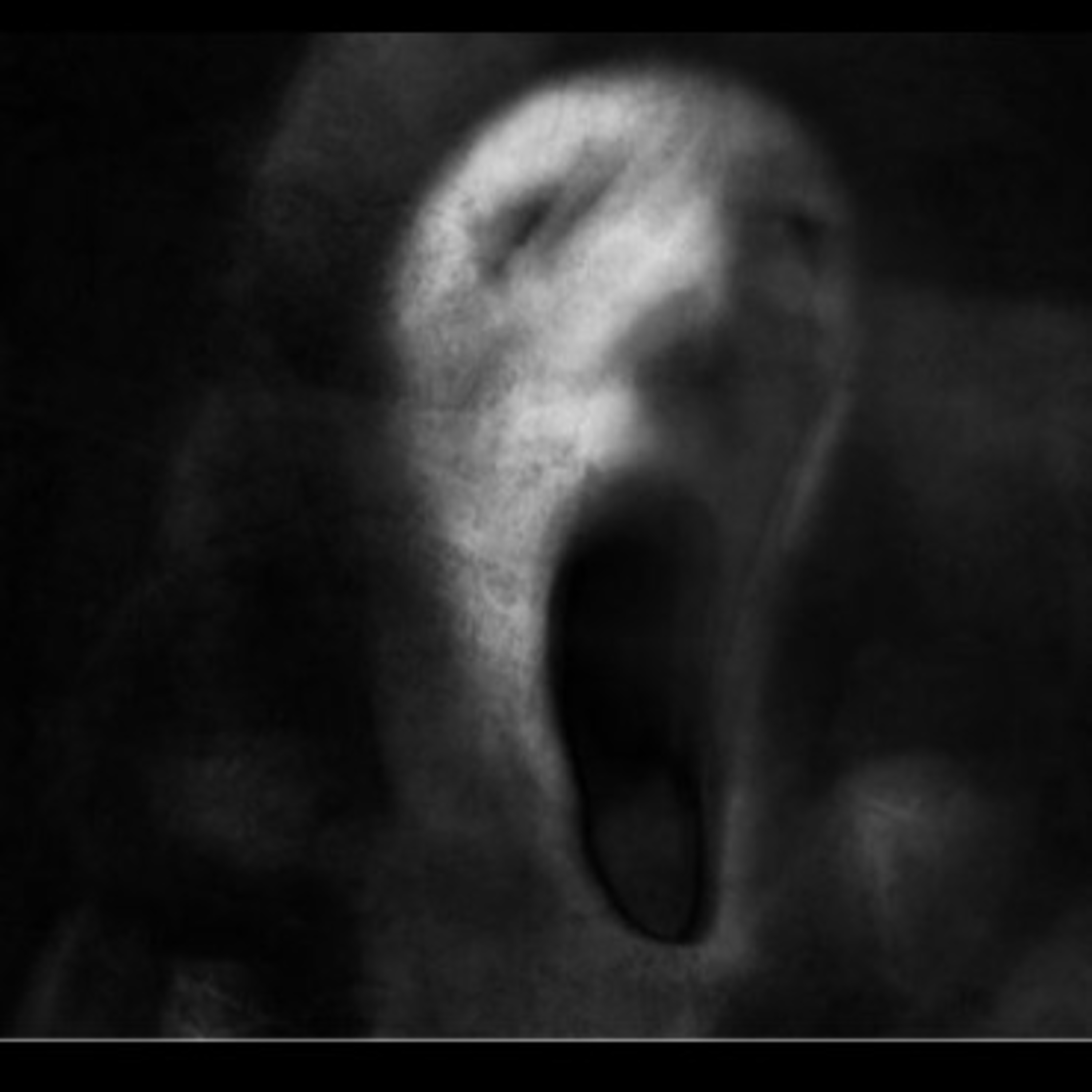 Creepypasta Fui no purgatório varias vezes pensando que tinha sonhos lúcidos (Ambuplay) episode artwork