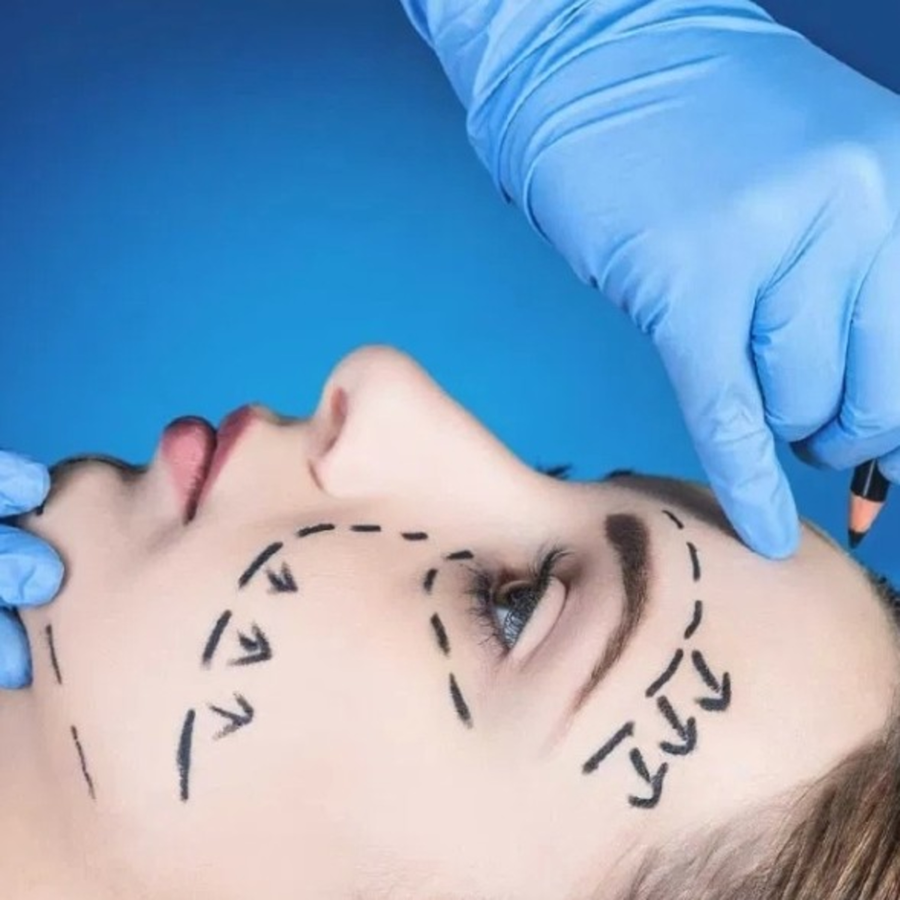 The surprising facts about ‘Plastic Surgery’  episode artwork