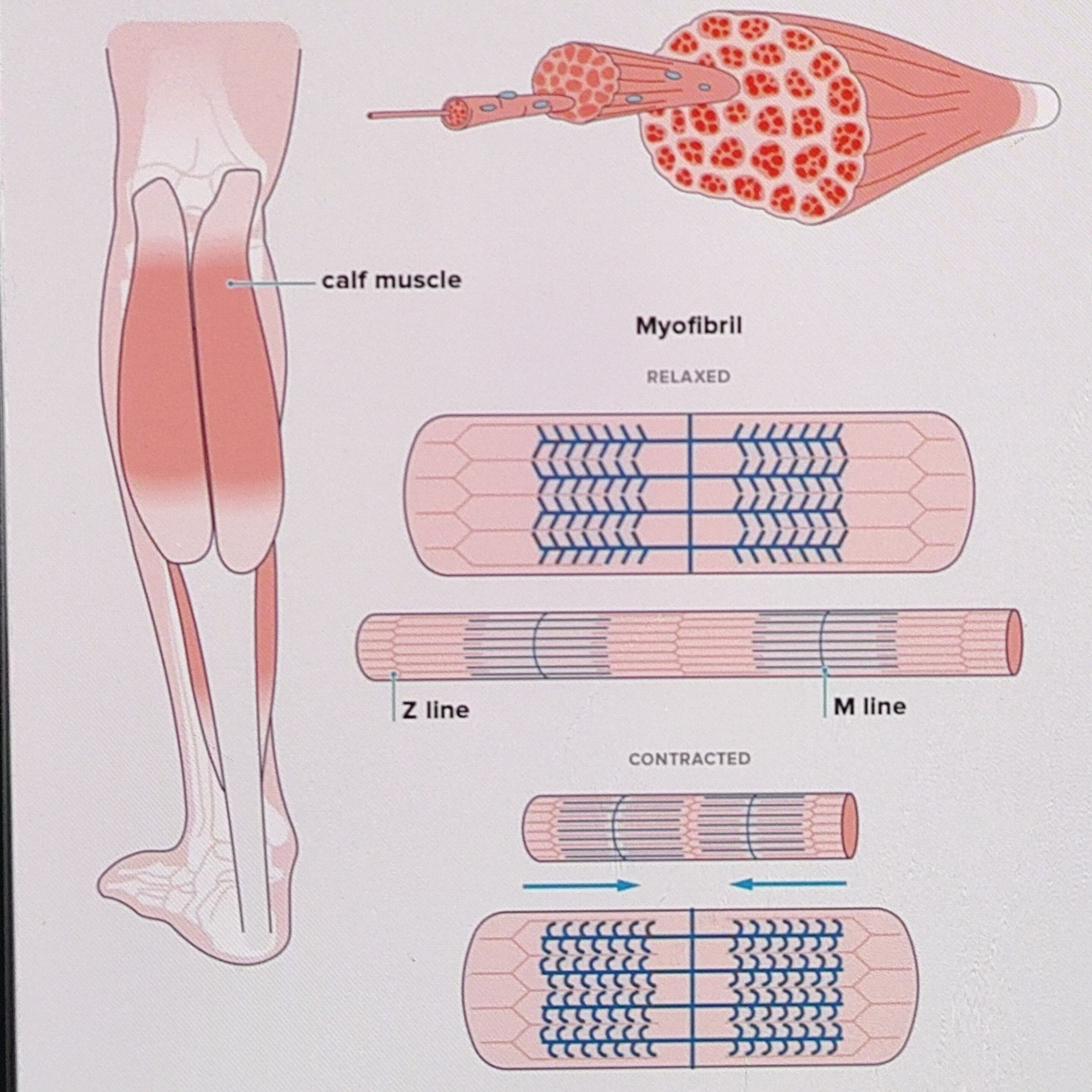What Causes Muscle Cramps?  episode artwork