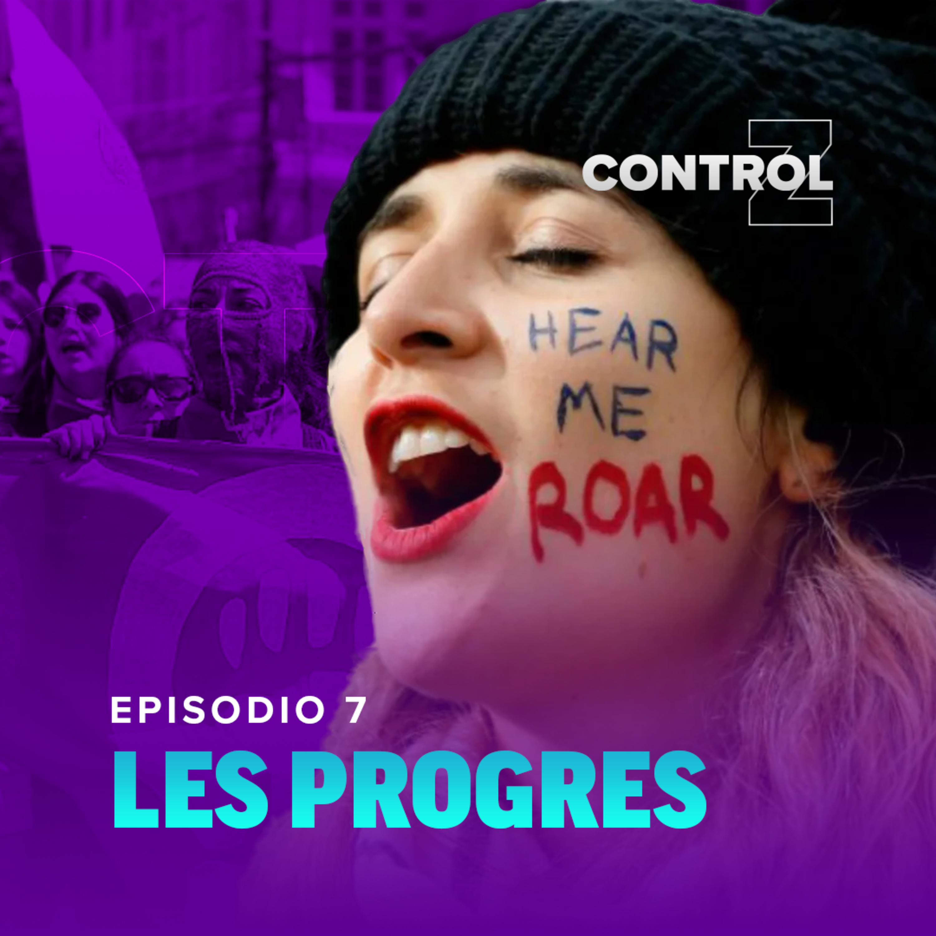 Episodio 7 - Les Progres episode artwork