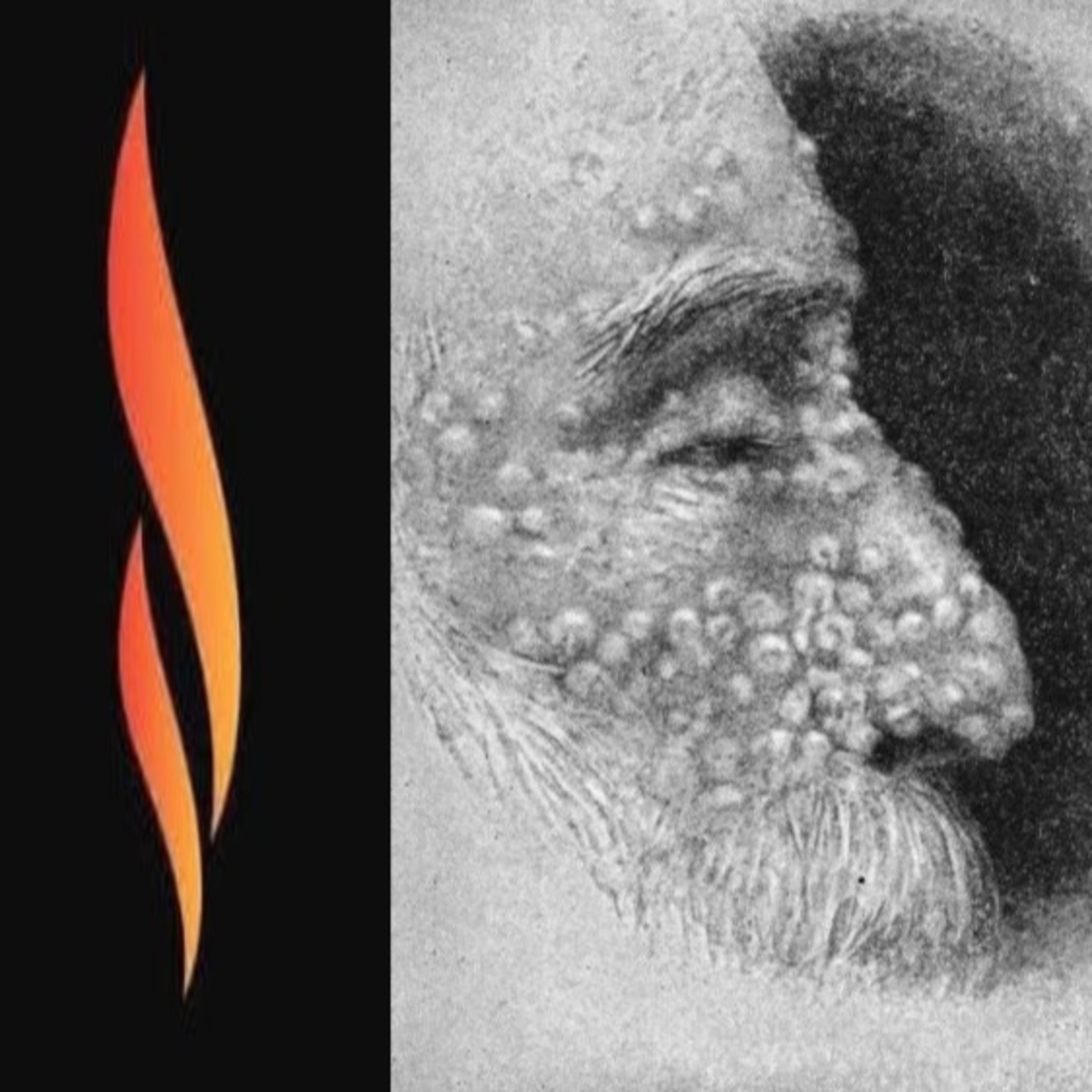 Revelation 16:1-2 Skin Marks  episode artwork