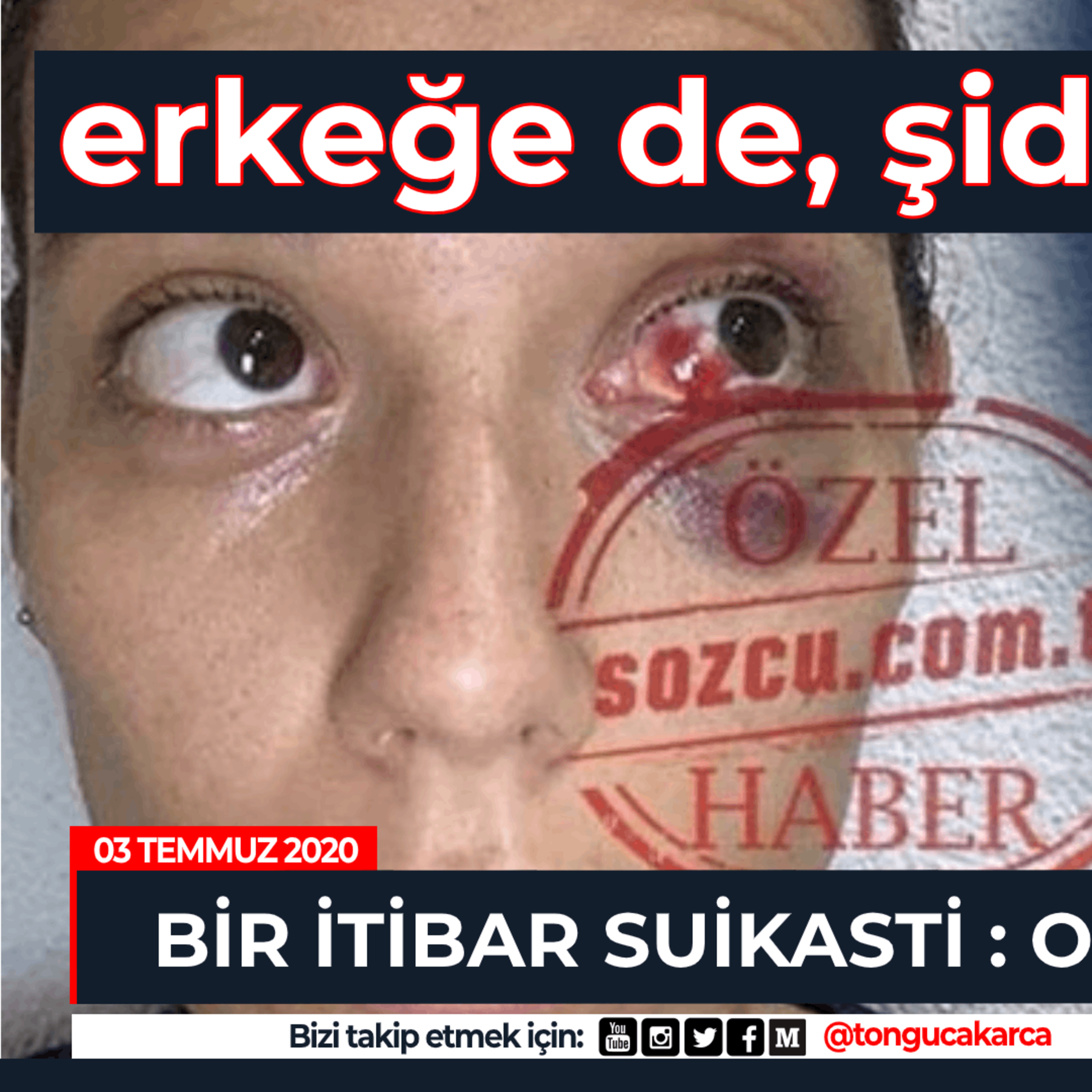 Az Bilinen O Podcast - Tonguç Akarca