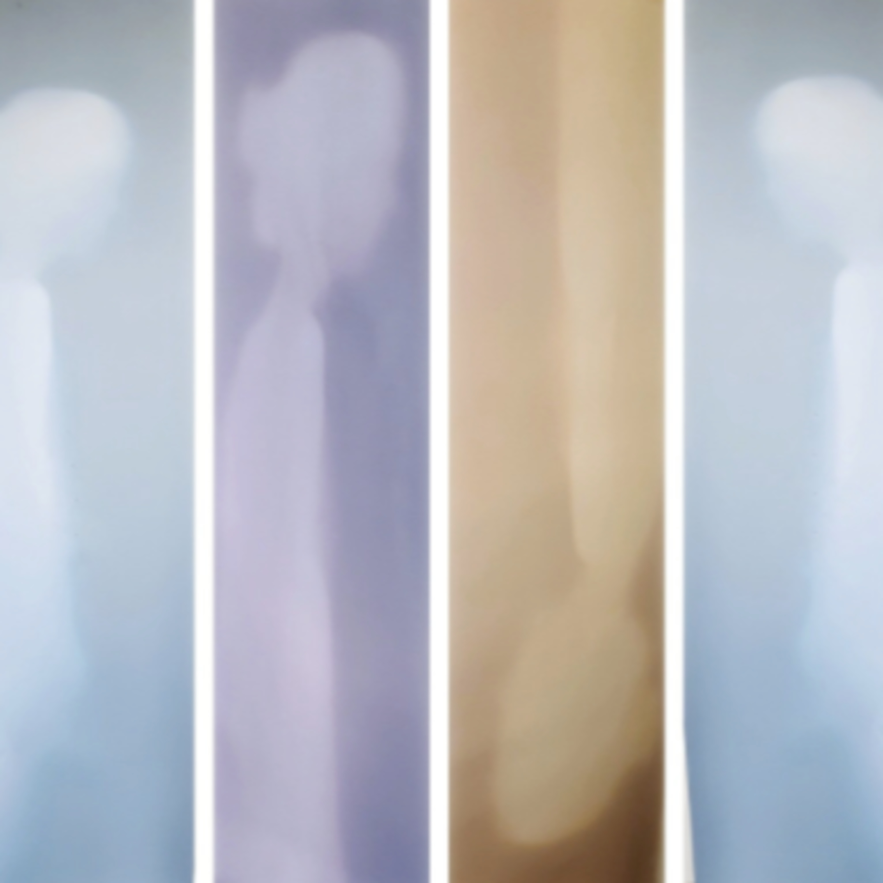 Photopocene