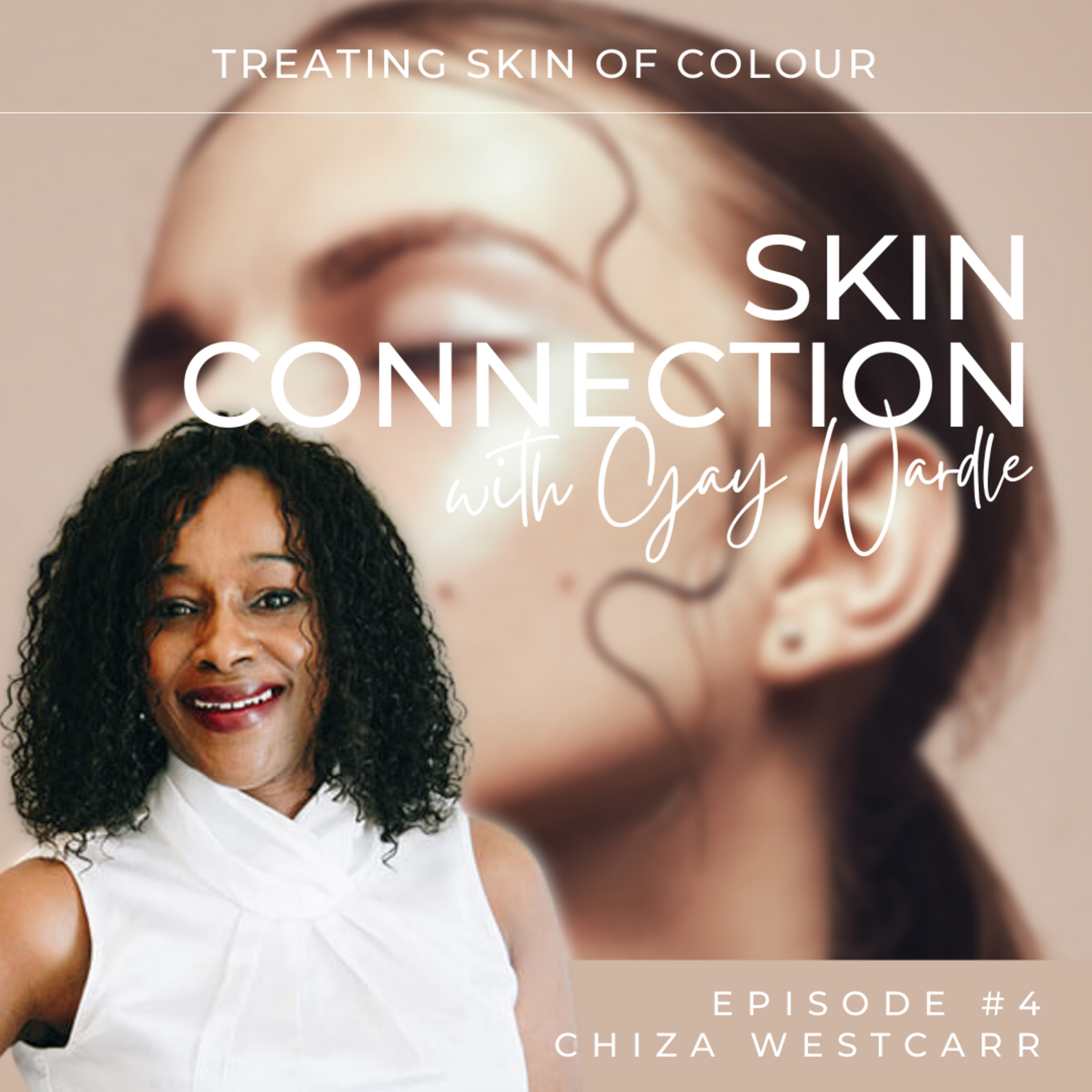 Skin Connection with Gay Wardle
