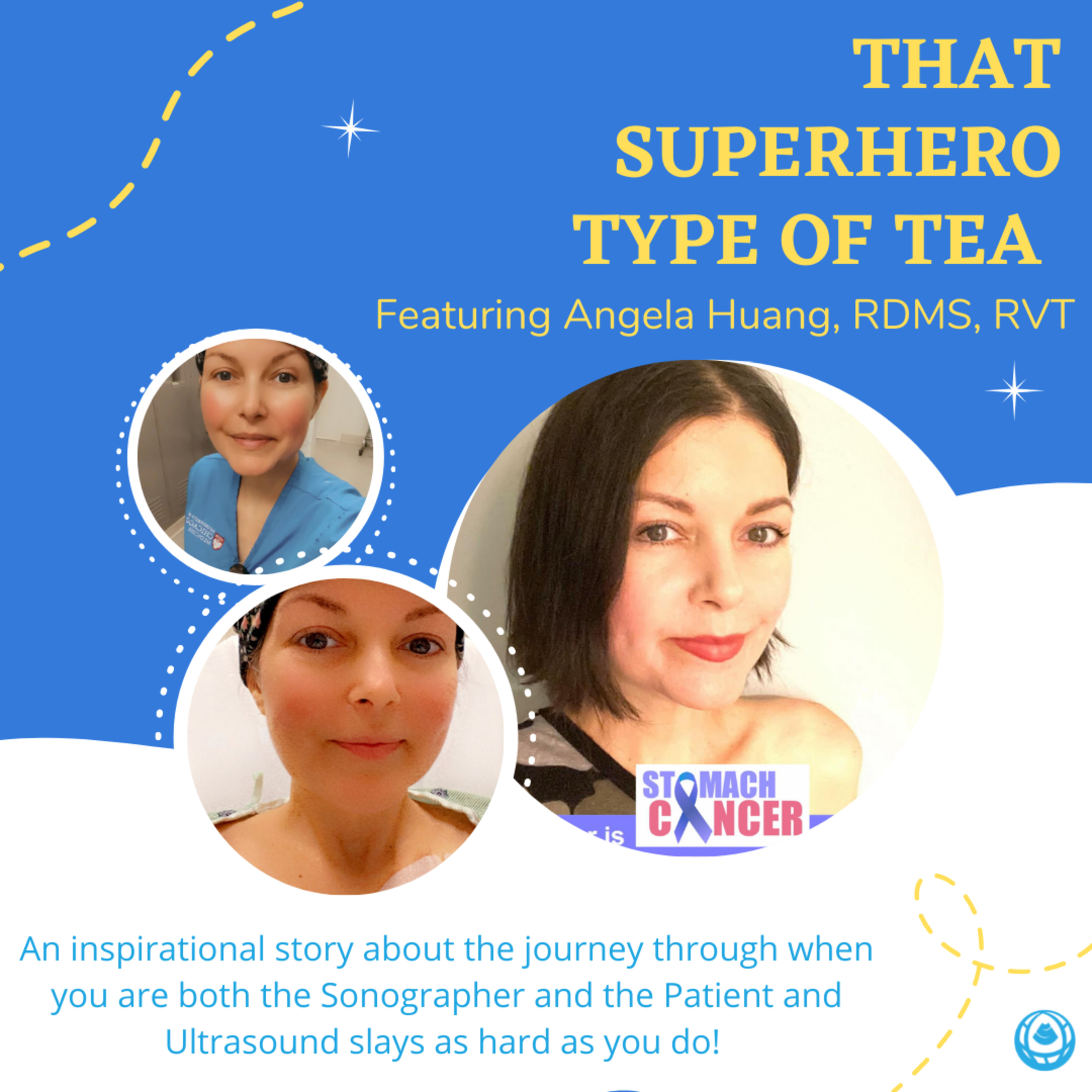 Sonographers Spill The Tea