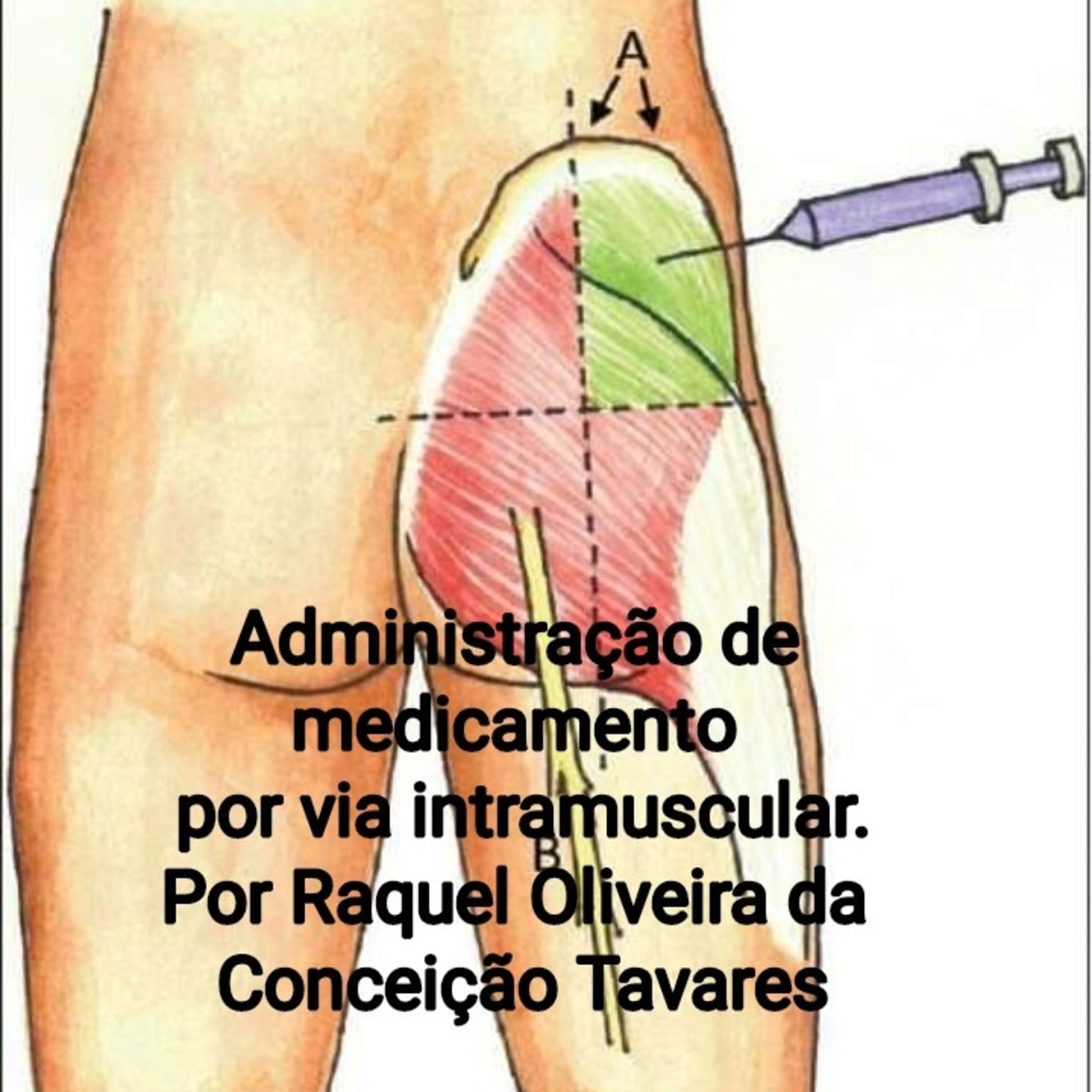 Administração por via intramuscular e seus cuidados