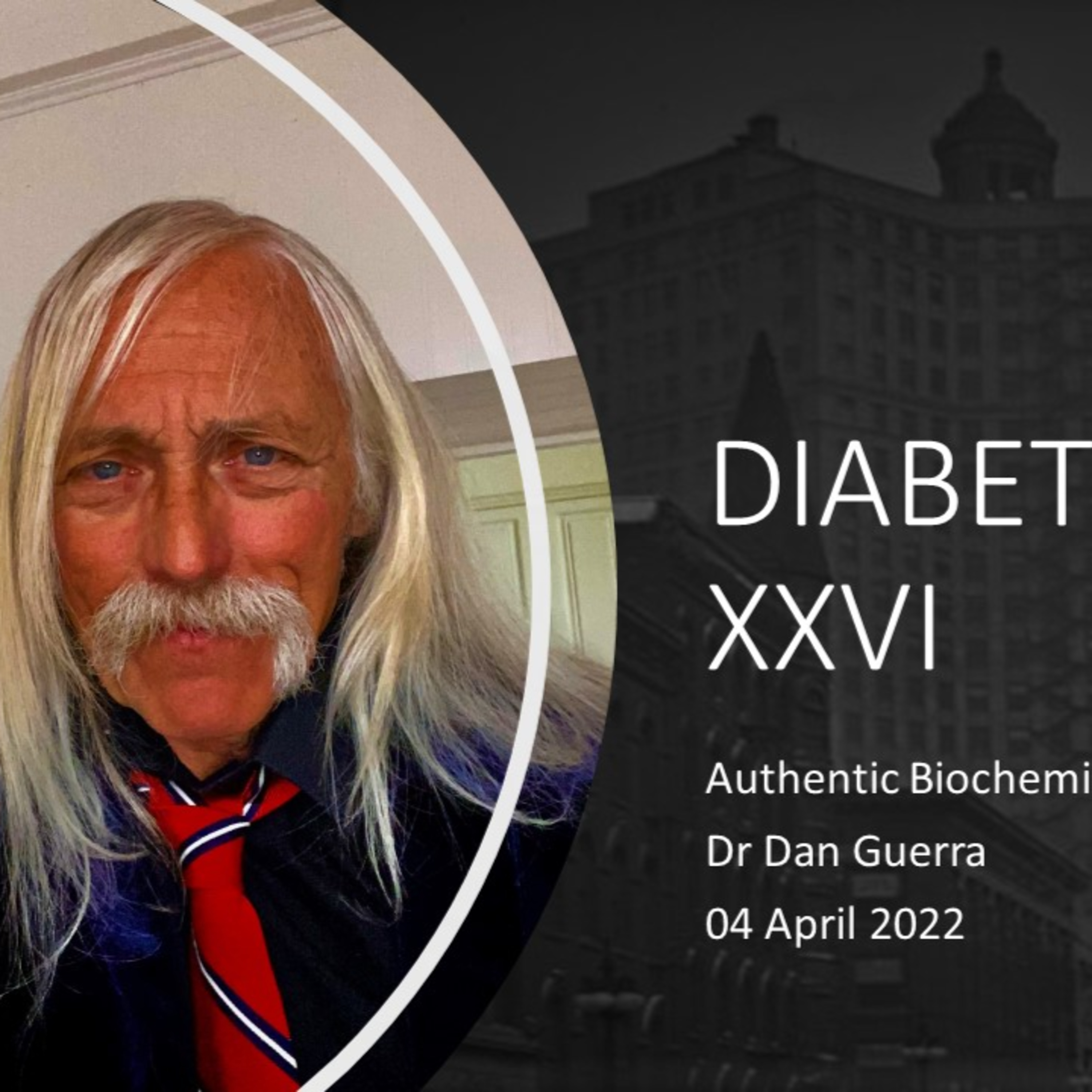 Diabetes XXVI. Adipogenic and hypertrophic adiposity differentially control dyslipidaemia and Insulin resistance in association with pro-inflammatory cytokine induced T2D and breast cancer.DJGPhD.