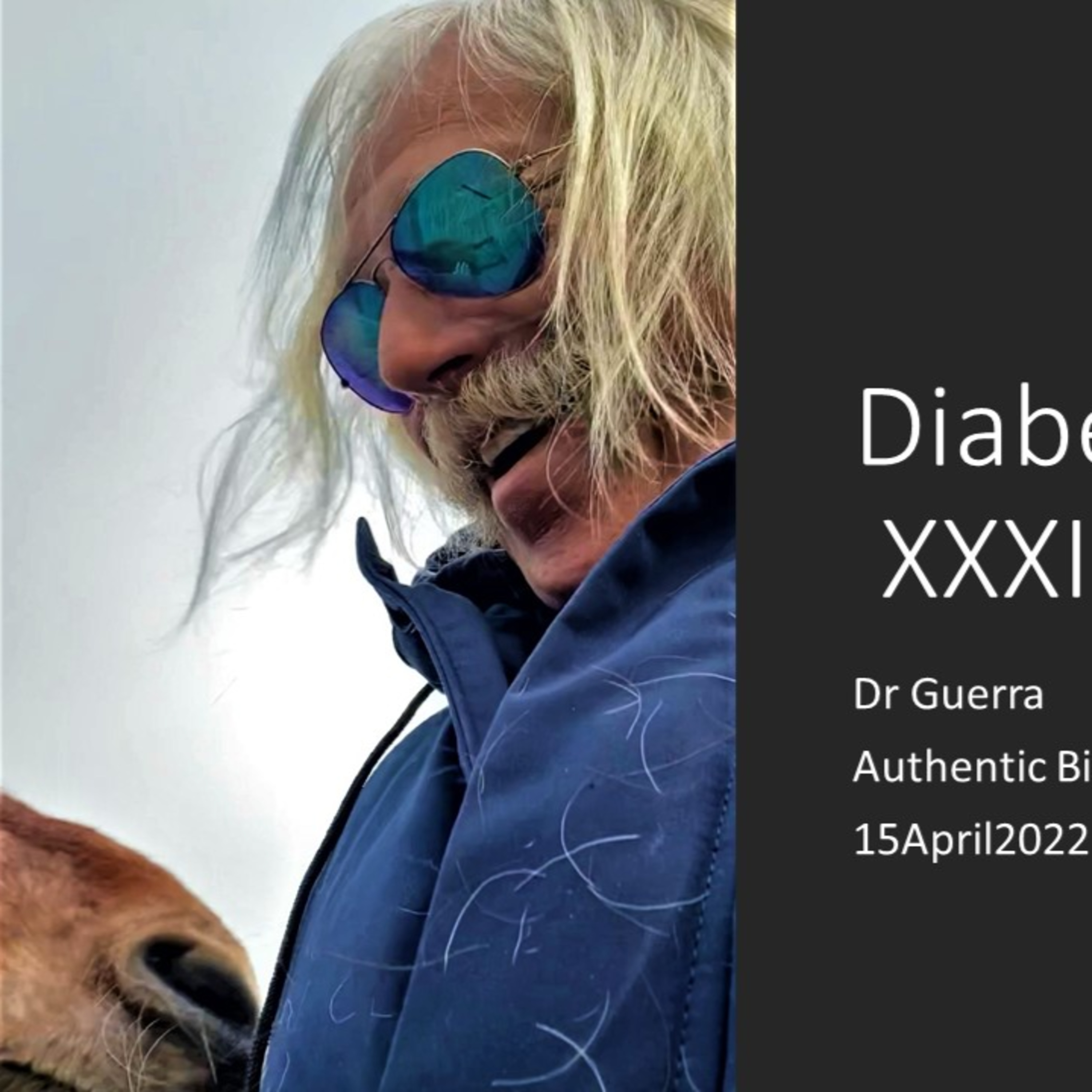 Diabetes XXXII. Fatty acid oxygenation and use of eicosanoid molecular species to regulate T2D-linked inflammation via the agonization of the nuclear receptor transcription factor PPAR.DJGPhD 15.4.22