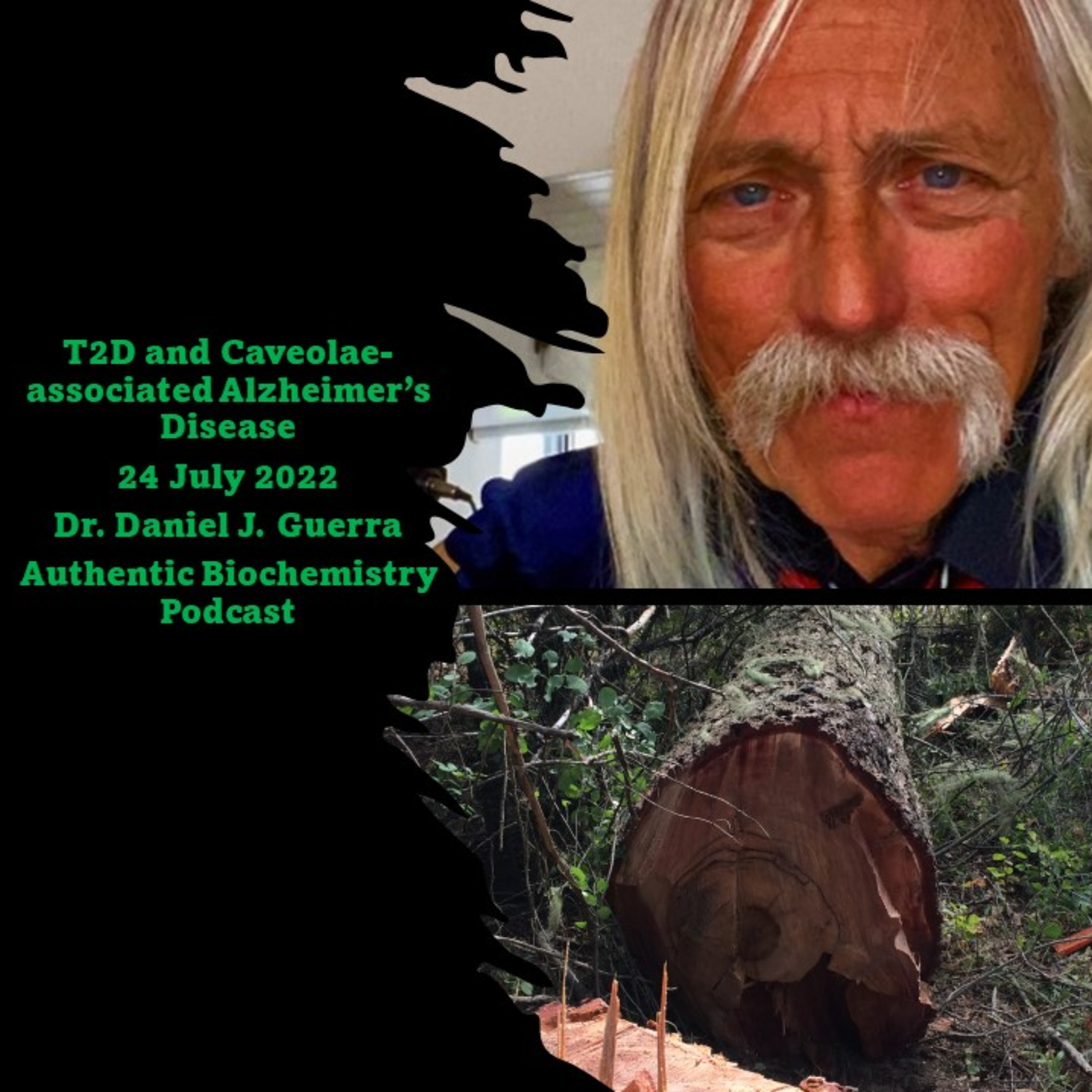 Membrane Biochemistry XX. Loss of CNS CA1-Caveolae Formation in Obese Type-2  Diabetics is Linked to insulin Resistance and Alzheimer's Disease. DJGPhD24.7.22. Authentic Biochemistry.