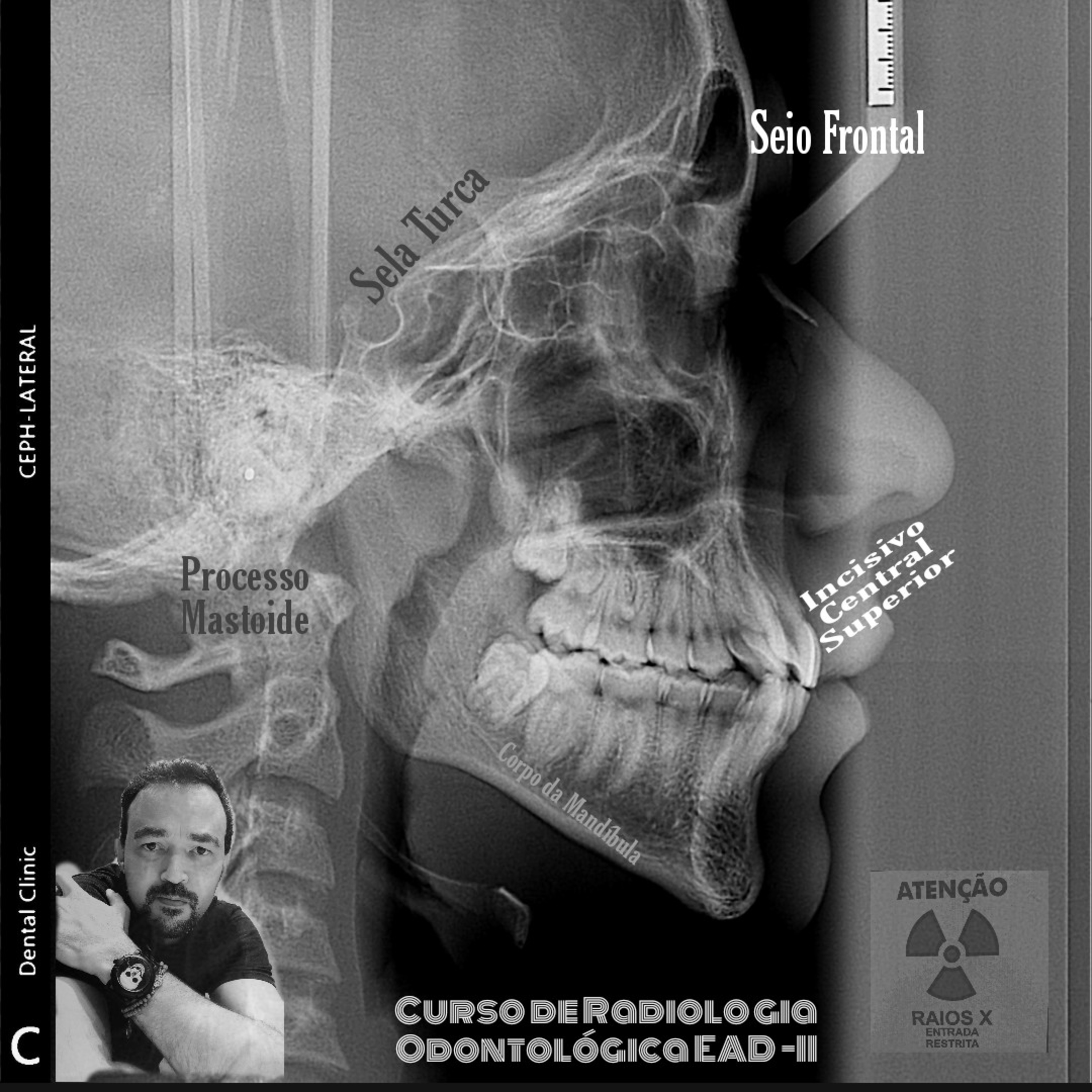 Radiologia Odontológica Forense.  episode artwork