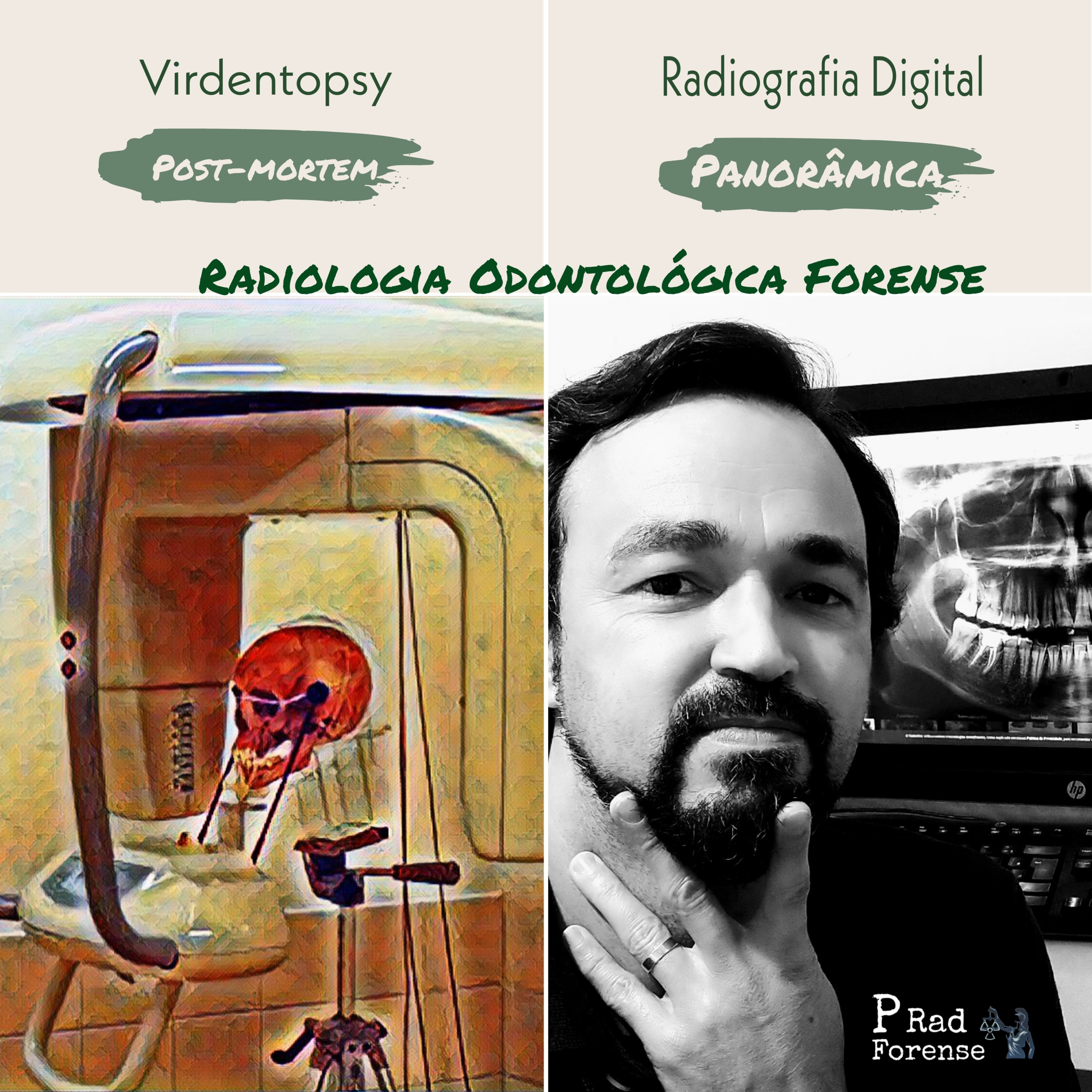 Radiologia Forense - Virdentopsy episode artwork