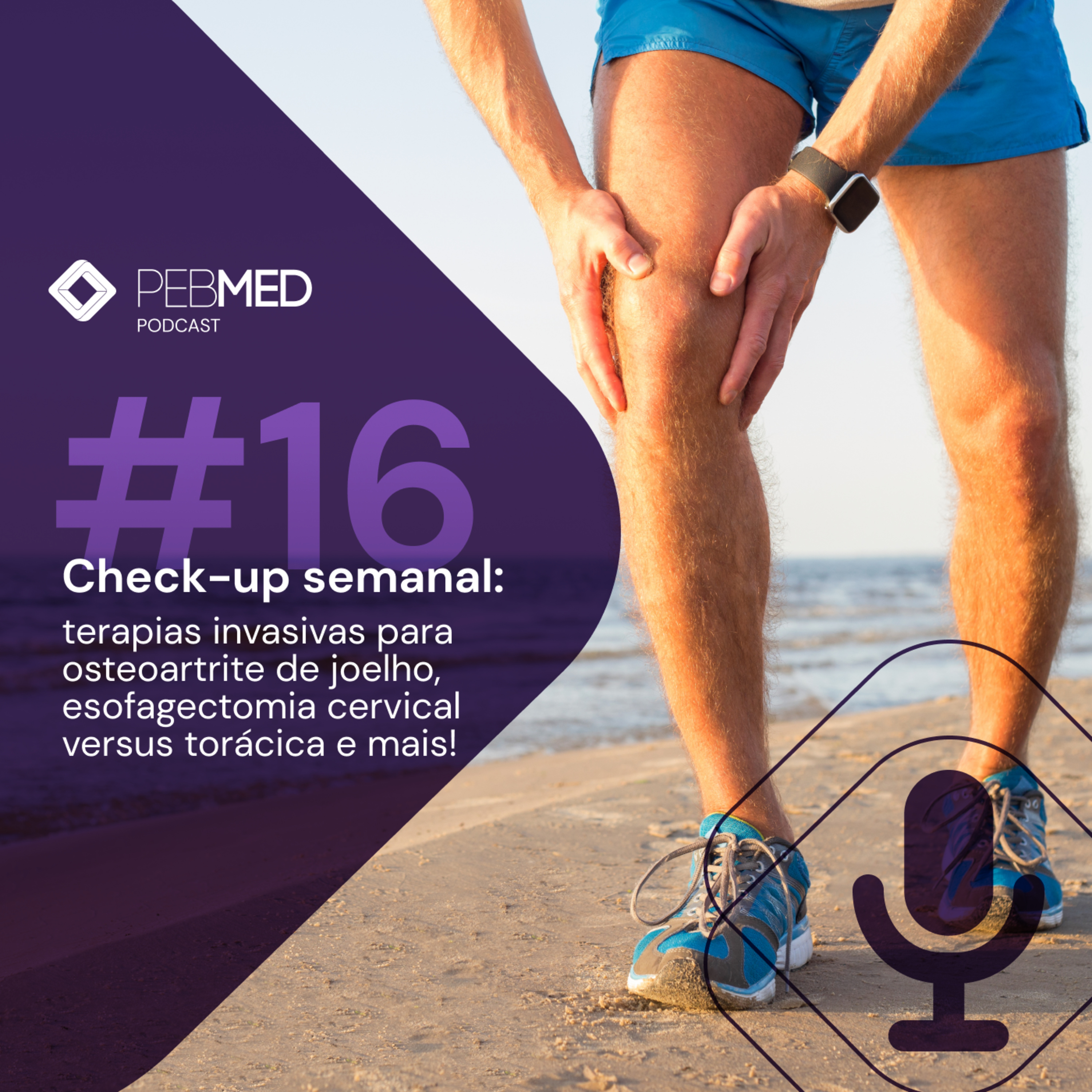 Check-up Semanal: terapias invasivas para osteoartrite de joelho, esofagectomia cervical versus torácica e mais! episode artwork