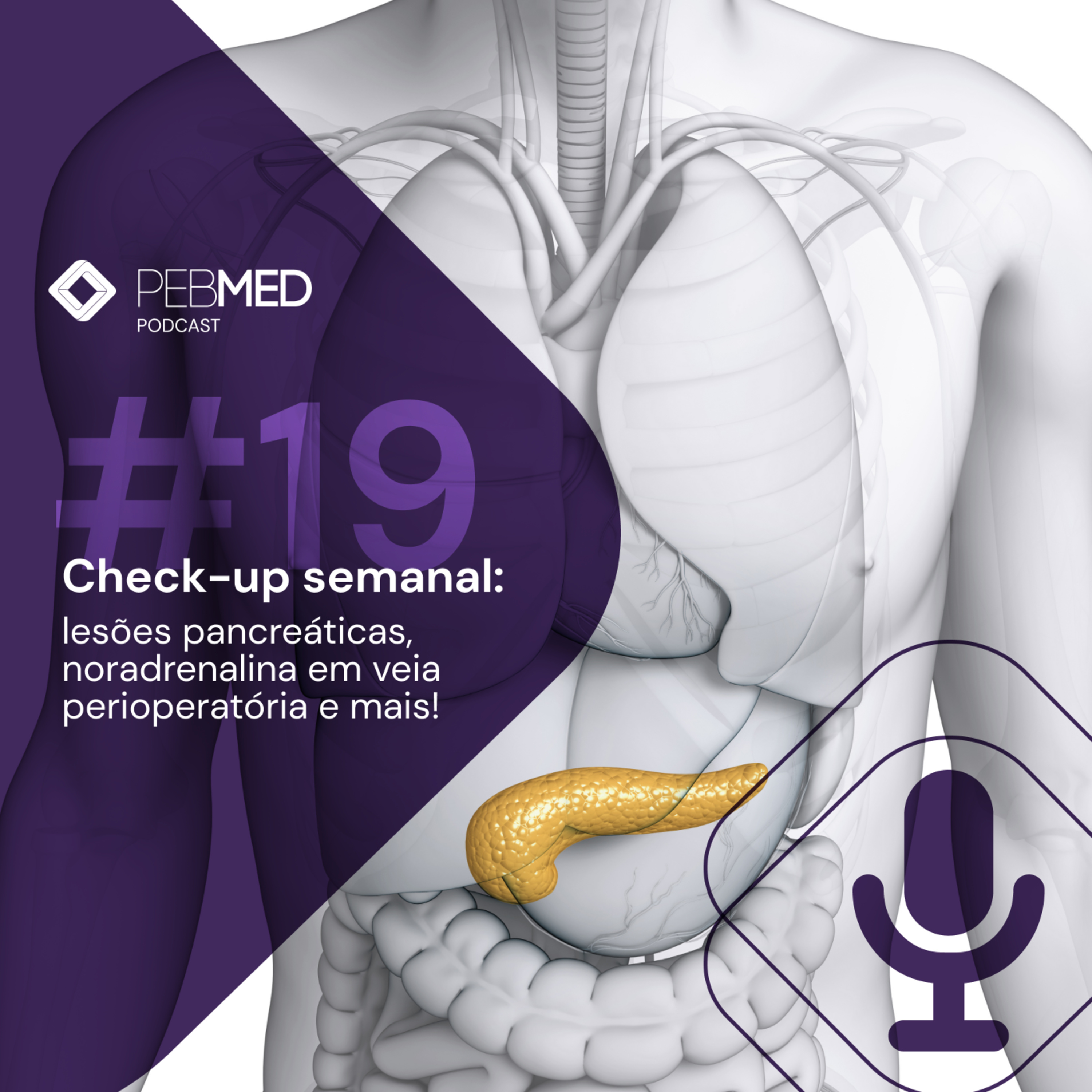 Check-up Semanal: lesões pancreáticas, noradrenalina em veia perioperatória e mais! episode artwork