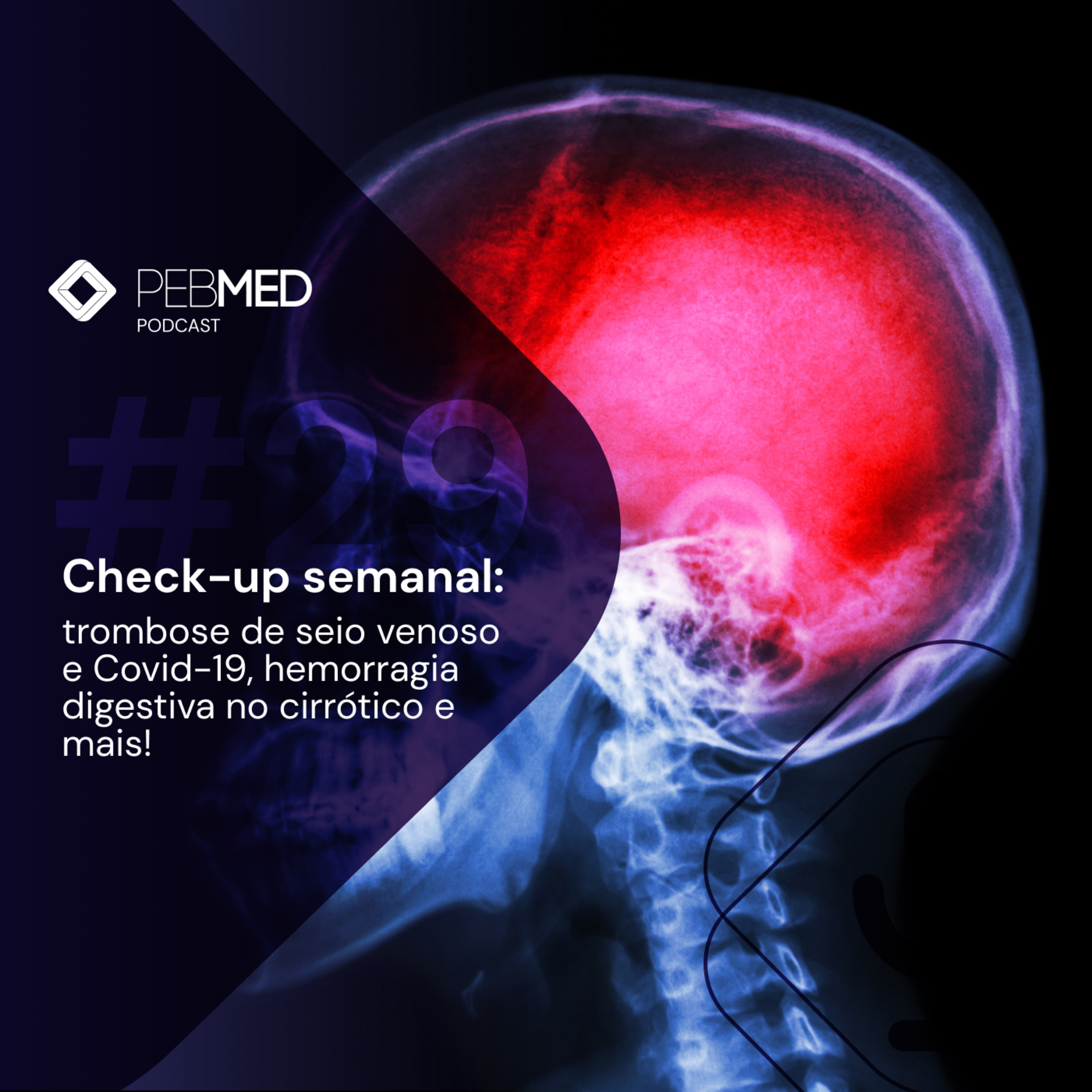 Check-up Semanal: trombose de seio venoso e Covid-19, hemorragia digestiva no cirrótico e mais! episode artwork