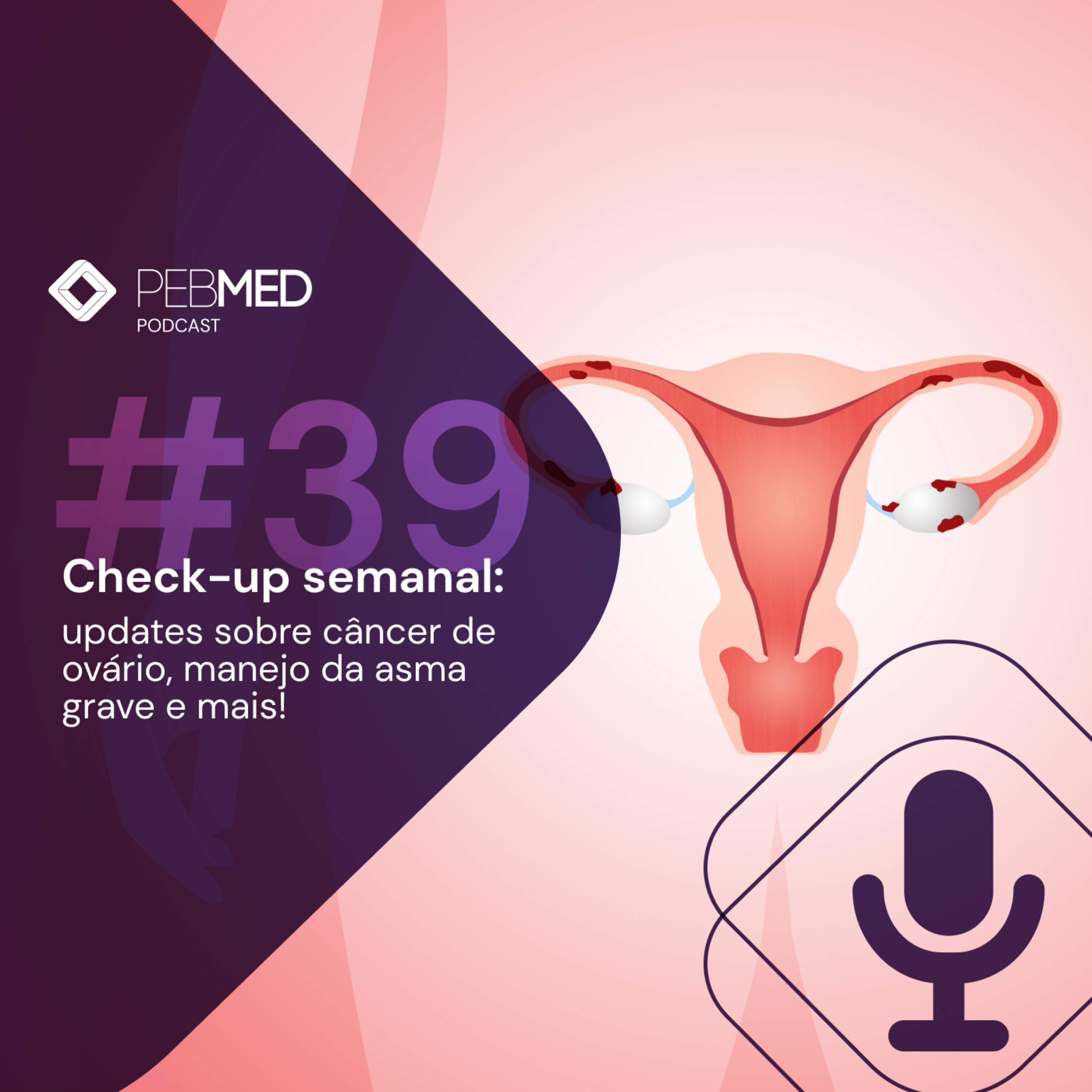 Check-up Semanal: updates sobre câncer de ovário, manejo da asma grave e mais! episode artwork