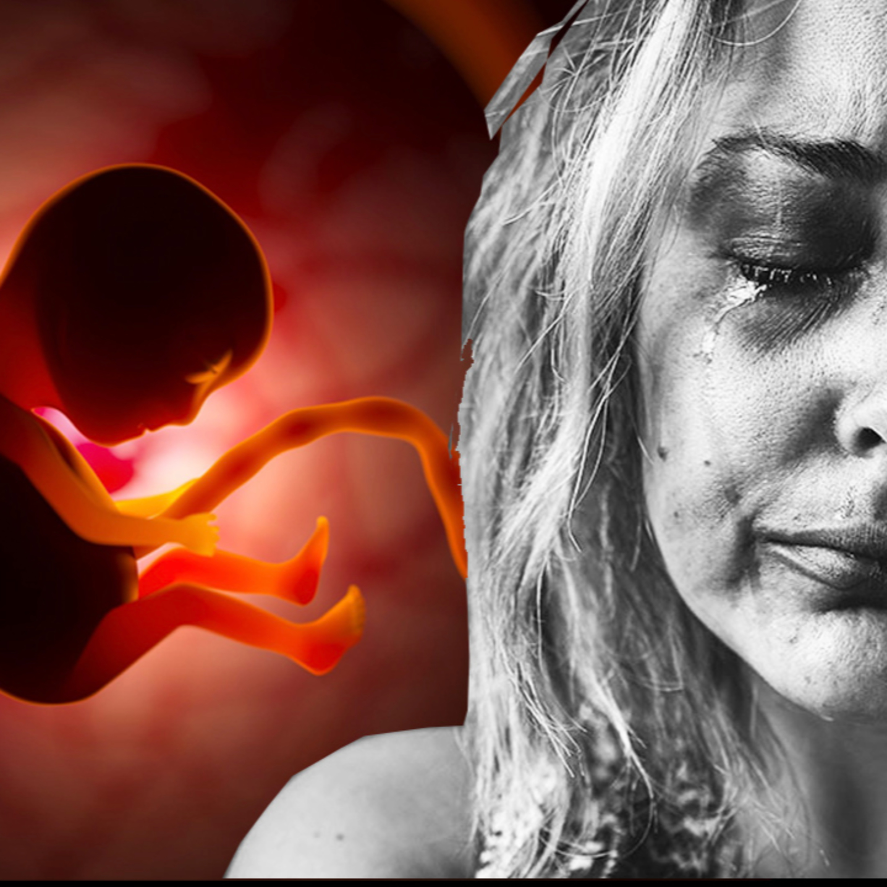 Avortement : que penser de l'interruption volontaire de la vie ?