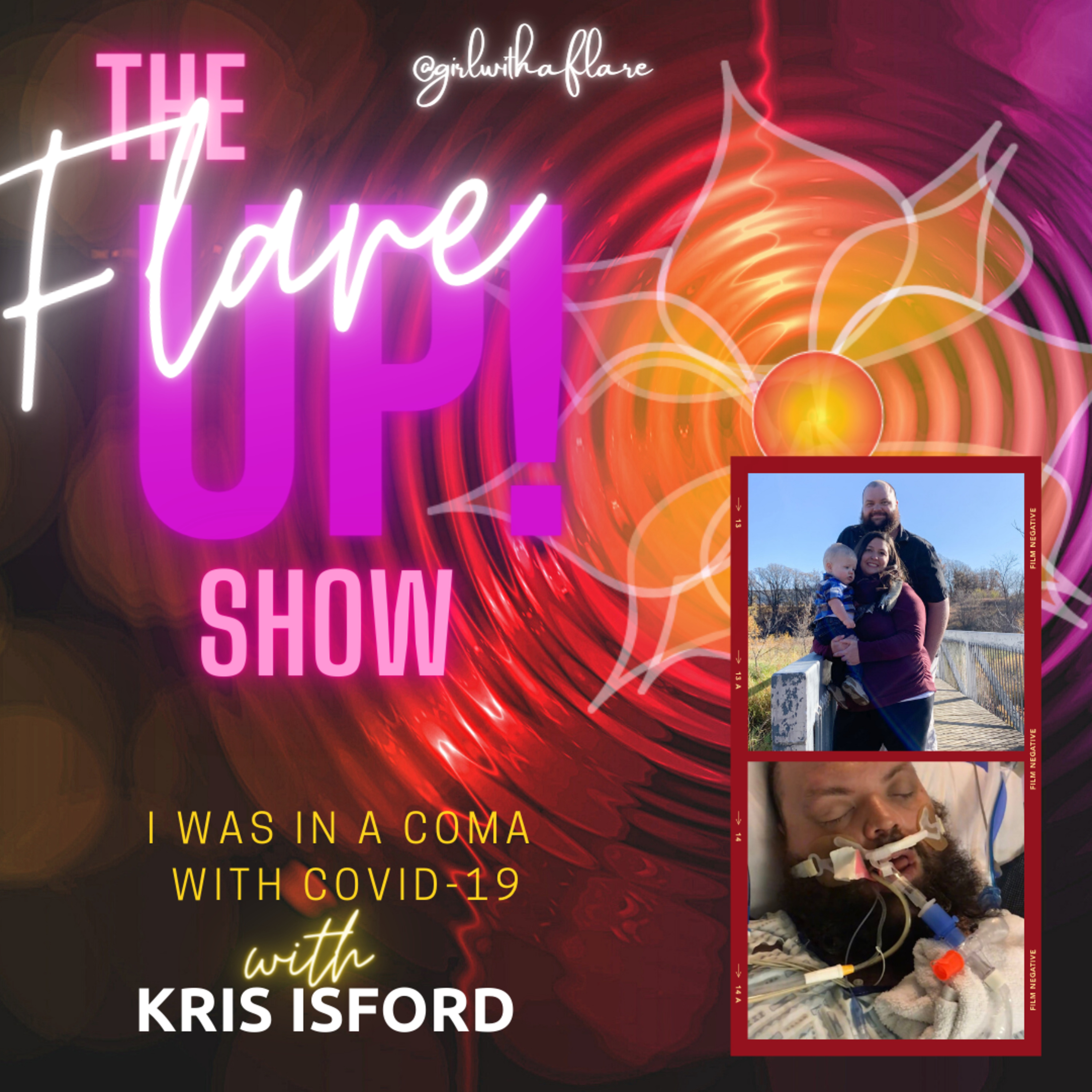 The Flare Up Show