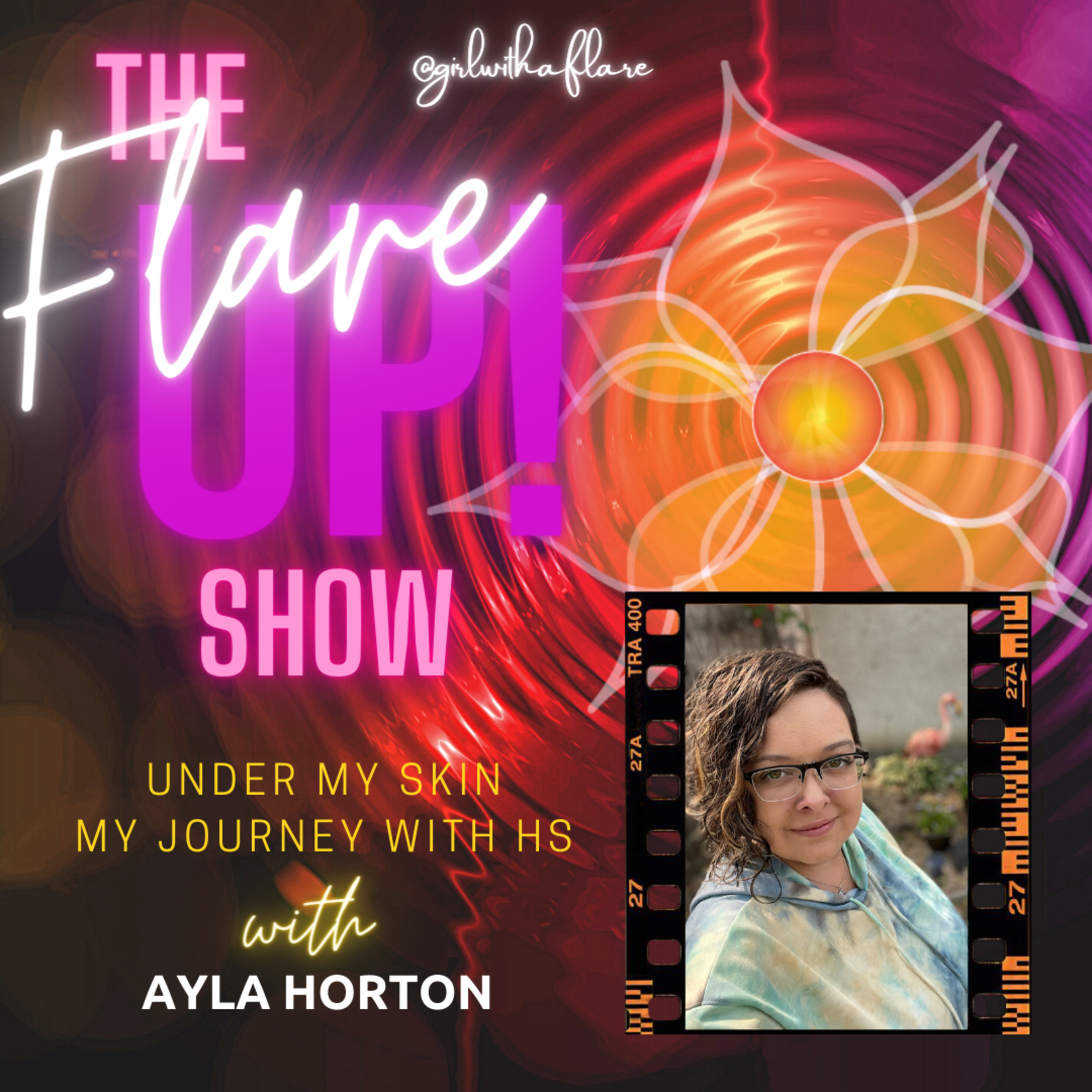 The Flare Up Show