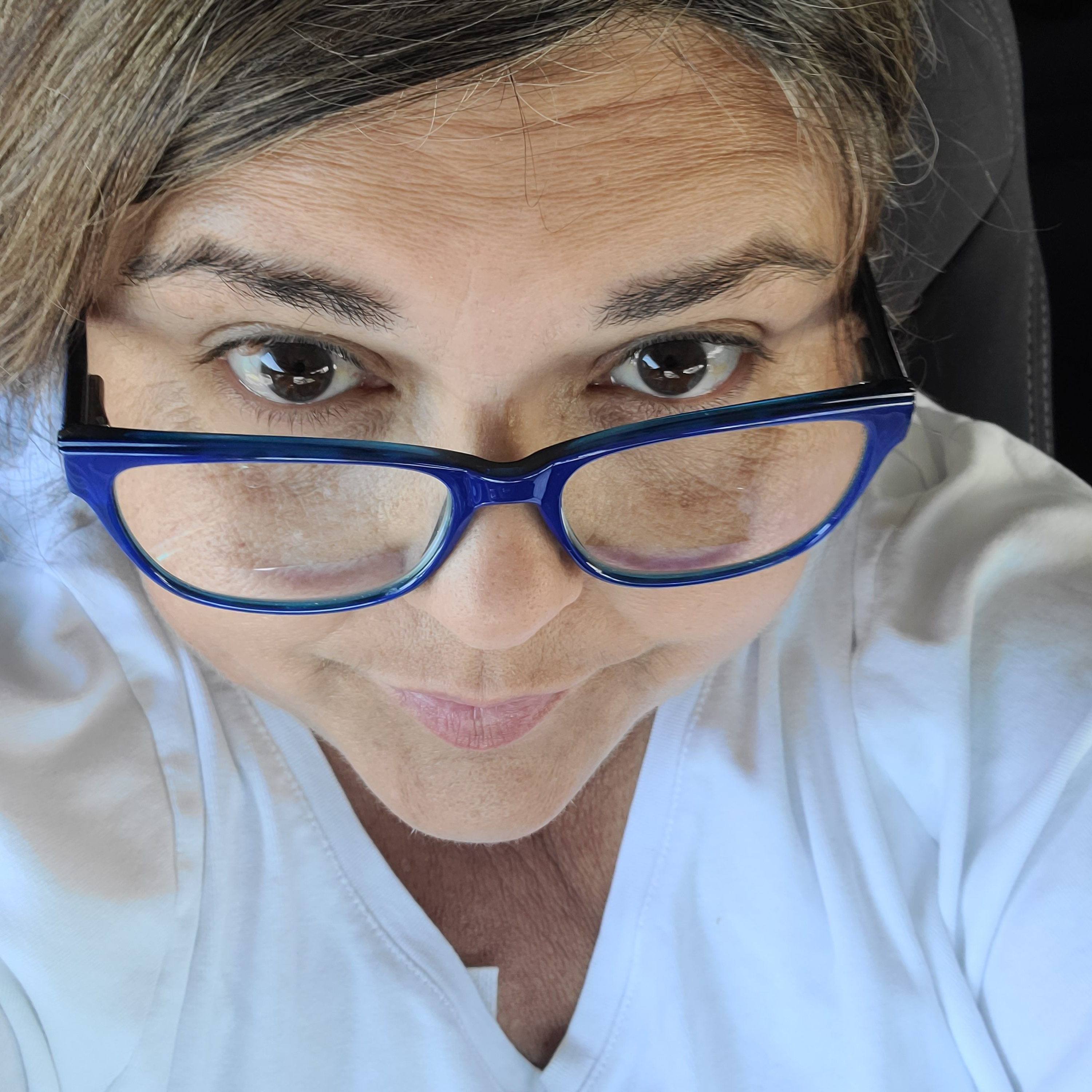 Bean Talk: Living In Kidney Failure