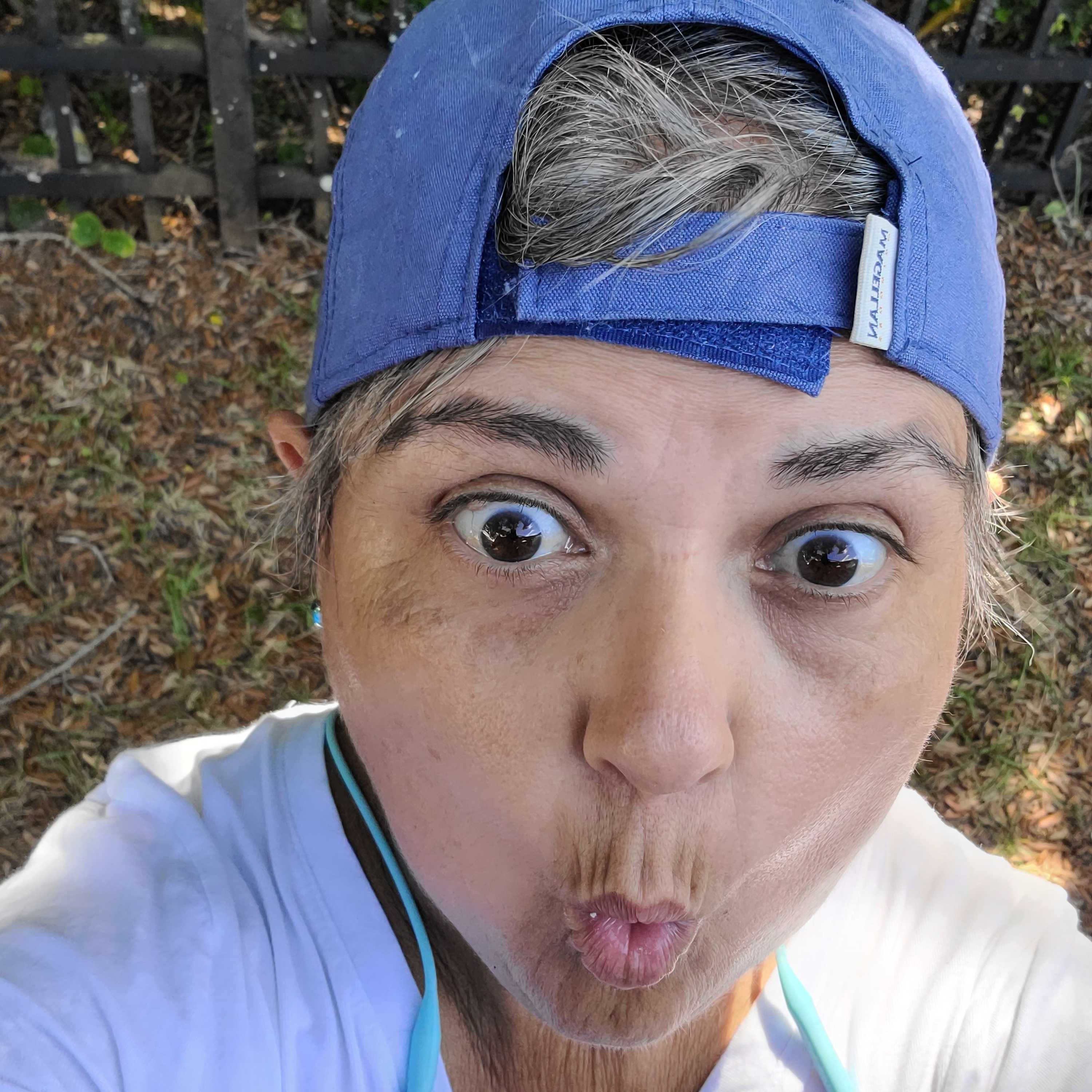 Bean Talk: Living In Kidney Failure