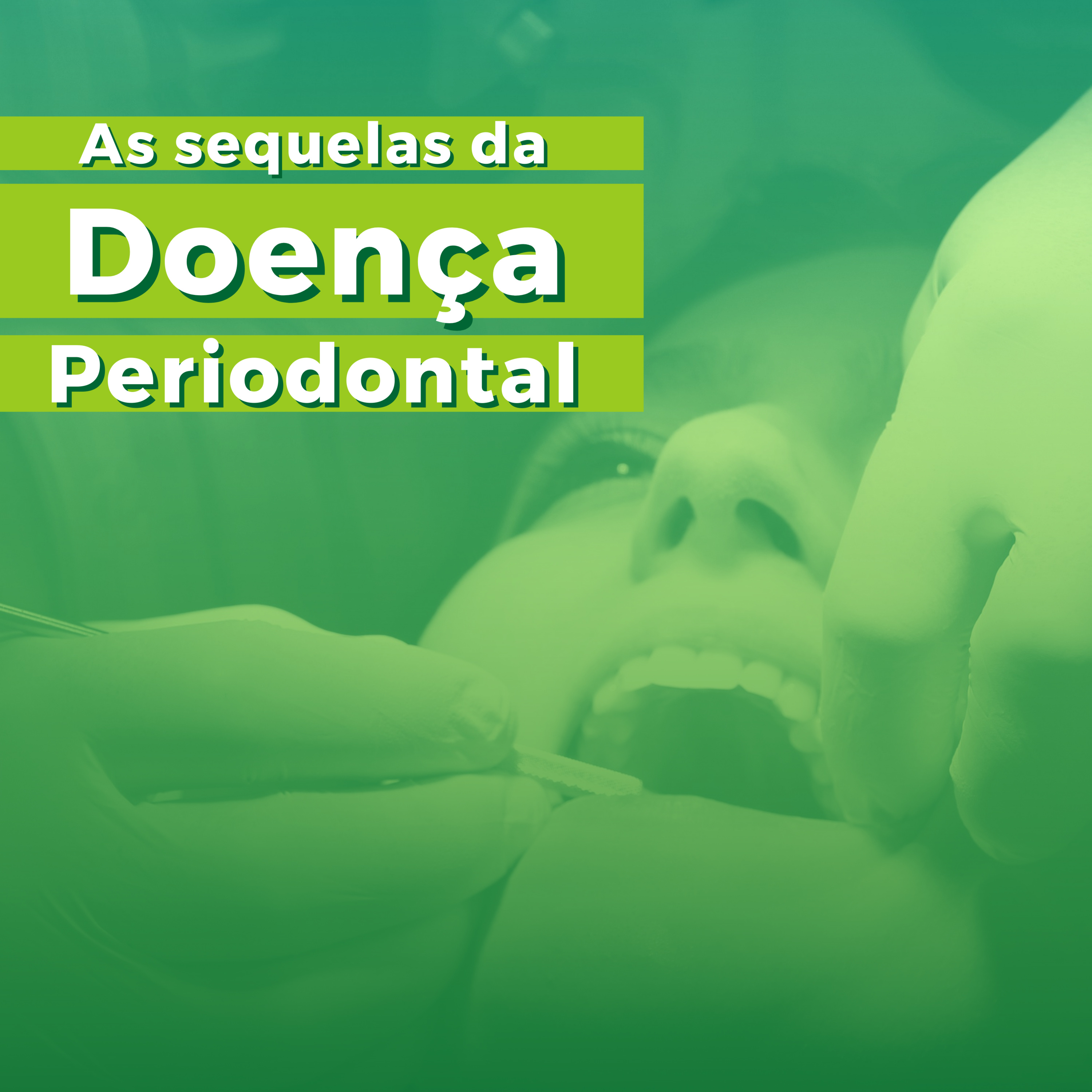 As sequelas da Doença Periodontal