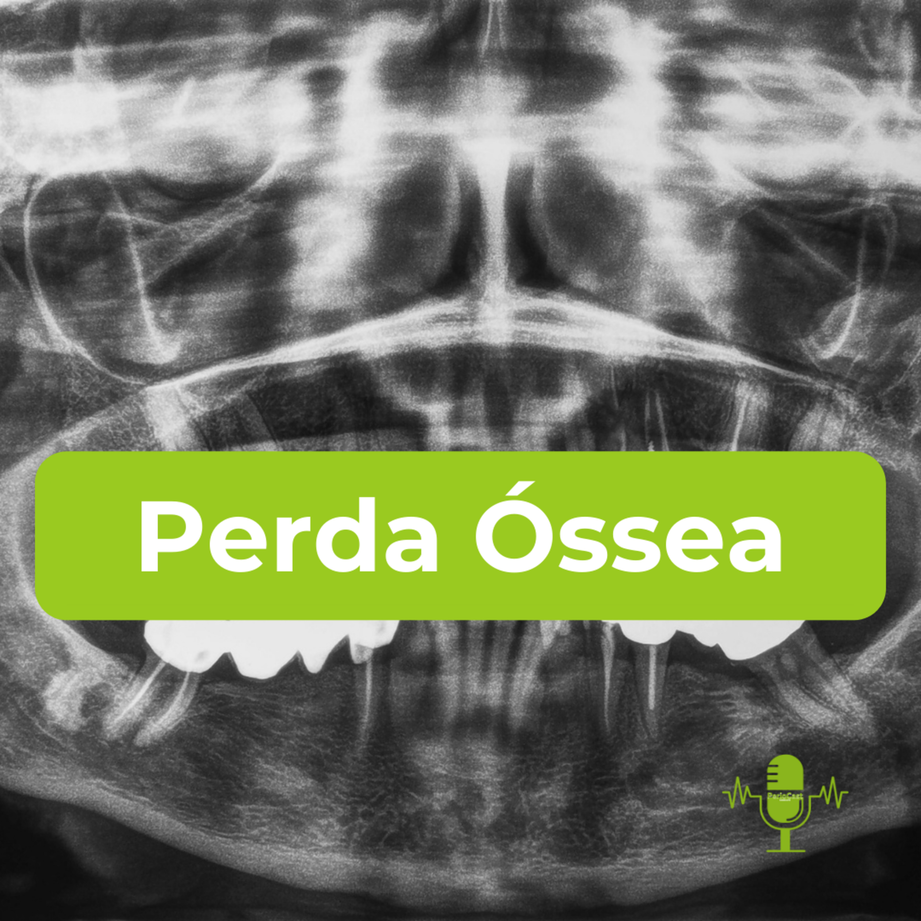 Perda Óssea