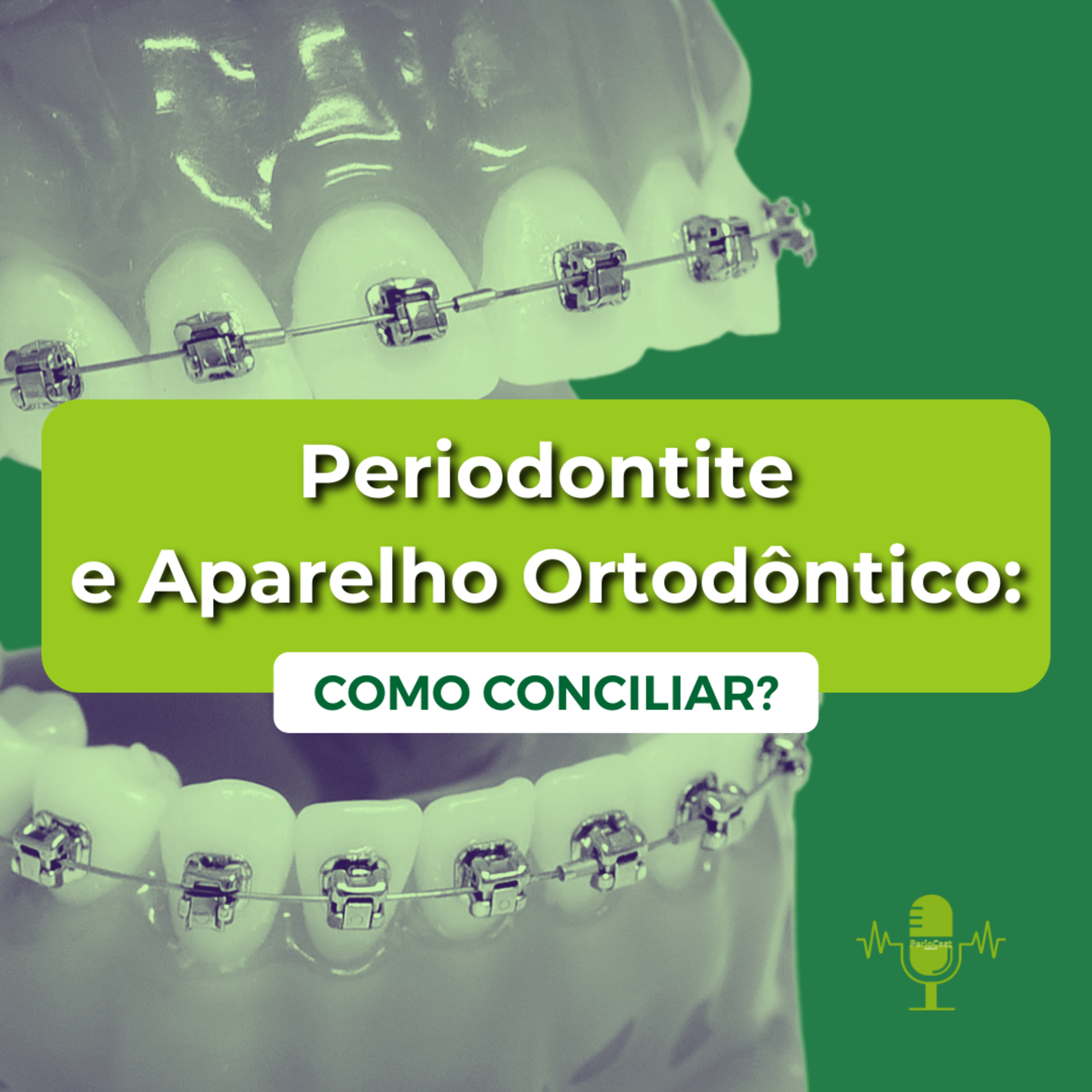 Periodontite e Tratamento Ortodôntico