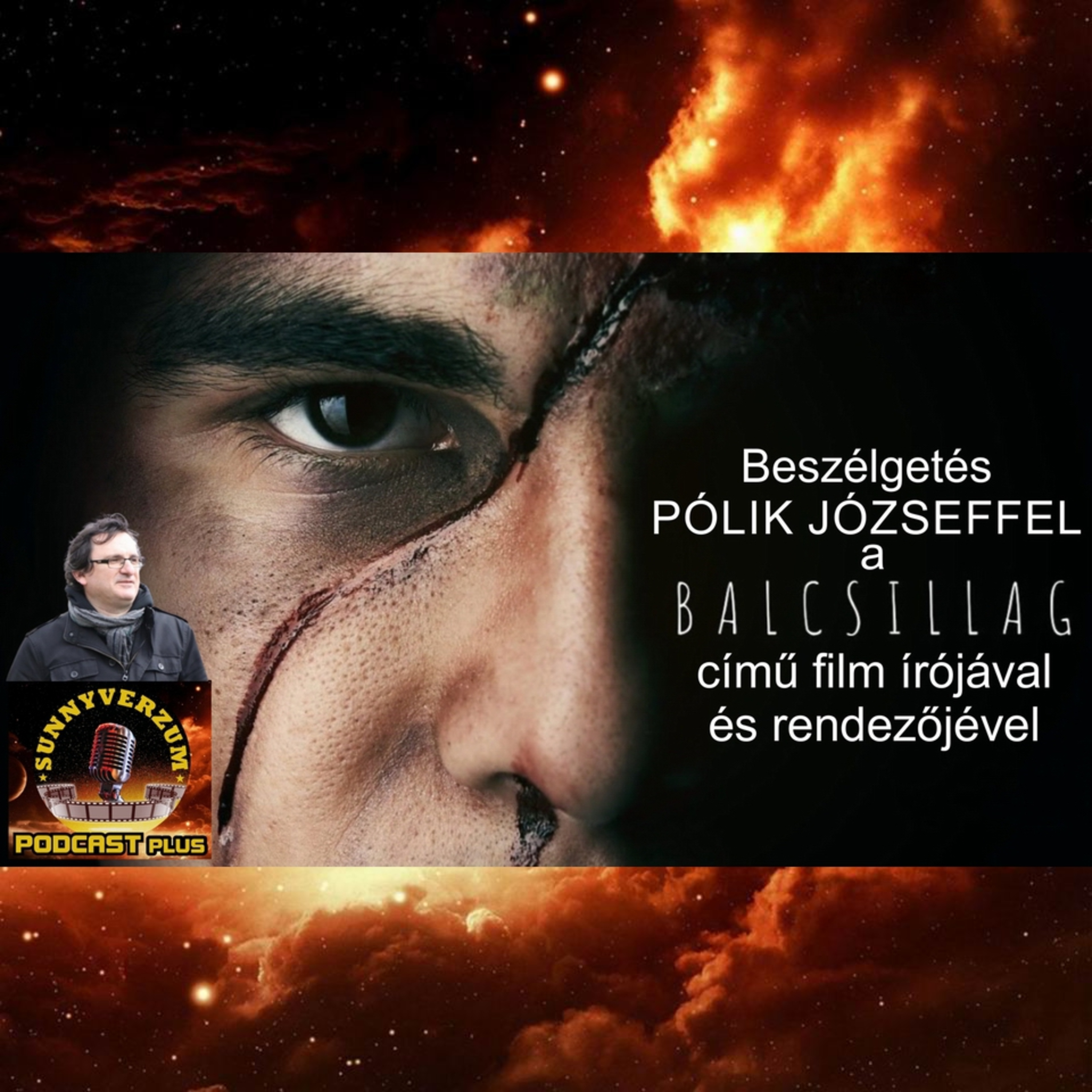 SunnyVerzum Podcast adások