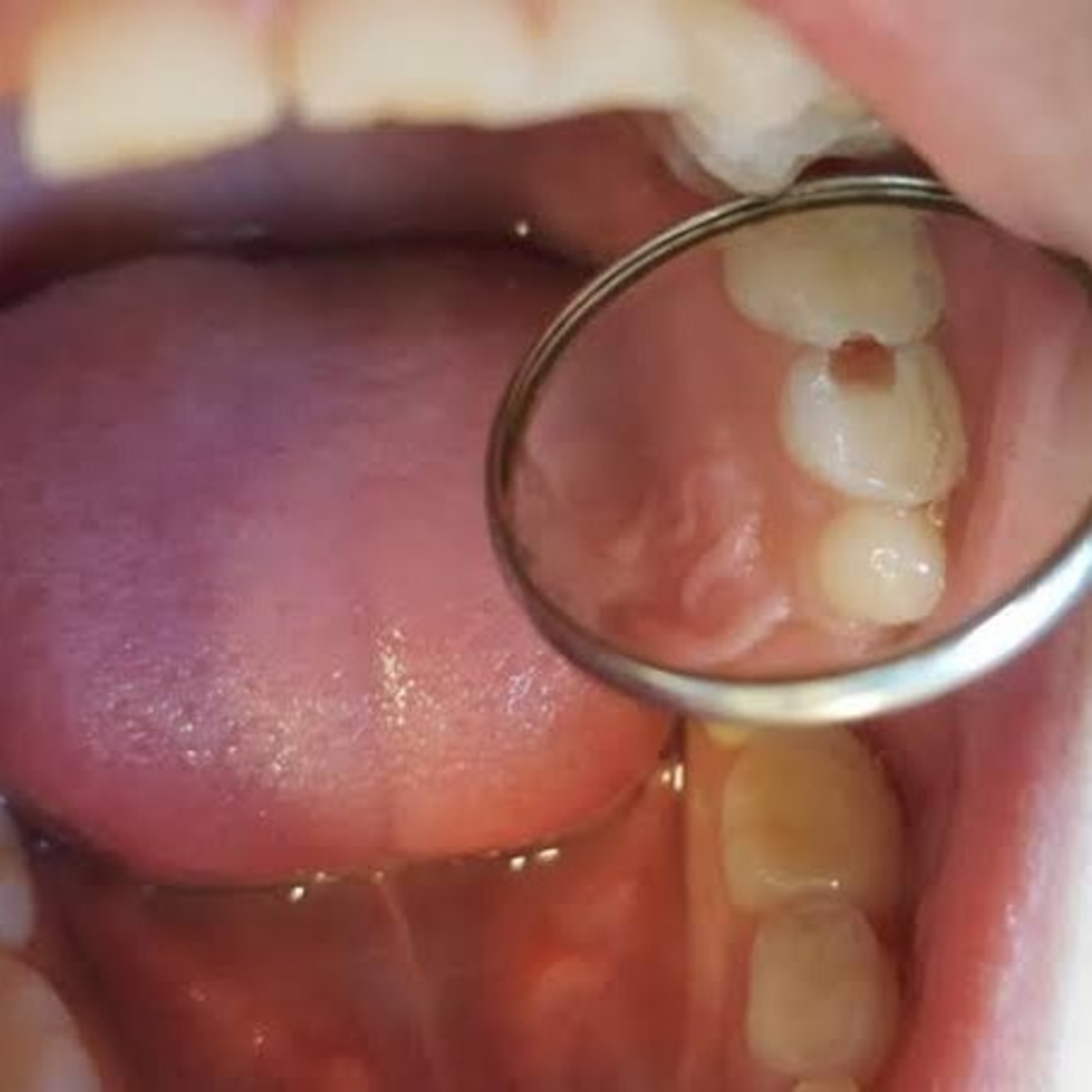 Odontopeques