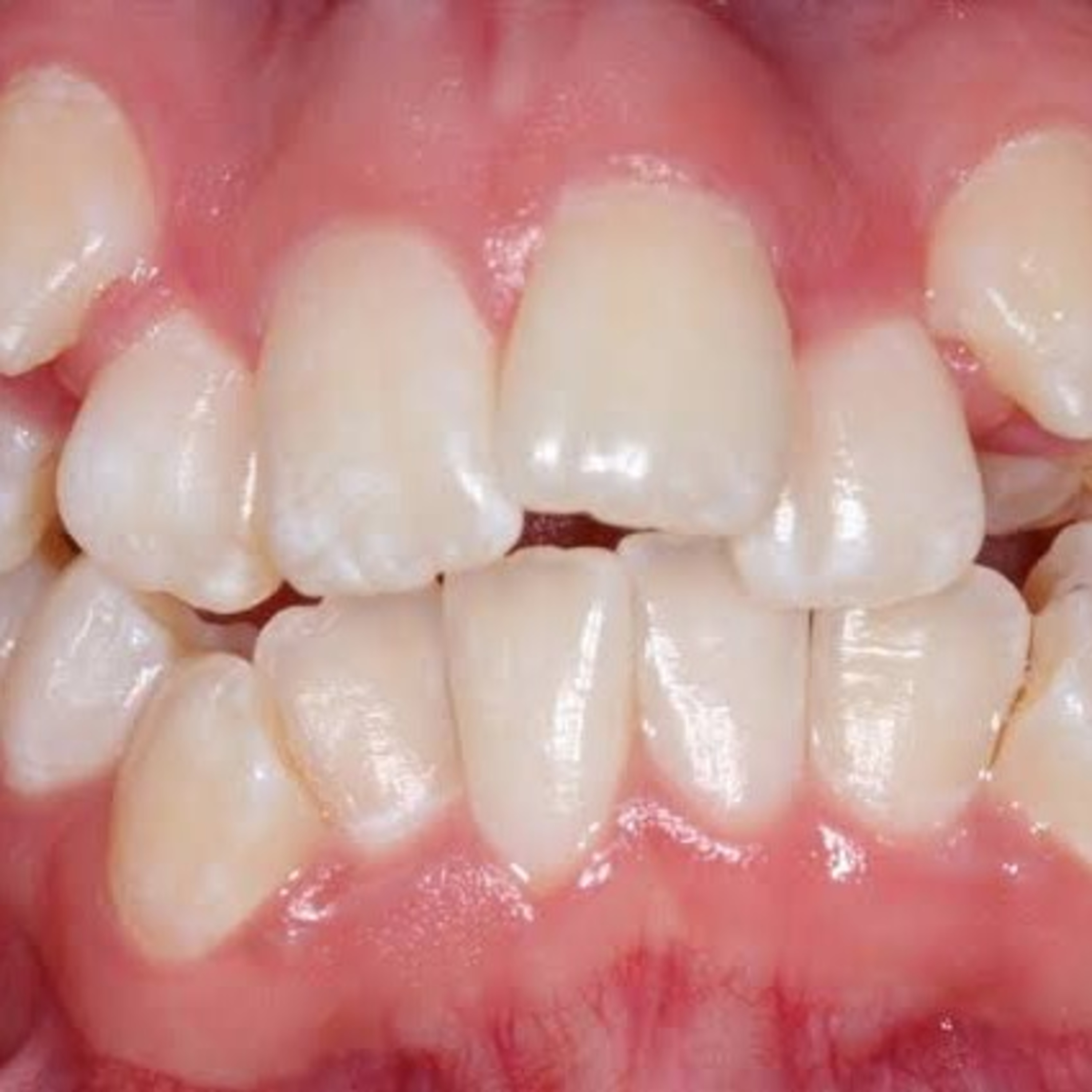 Odontopeques