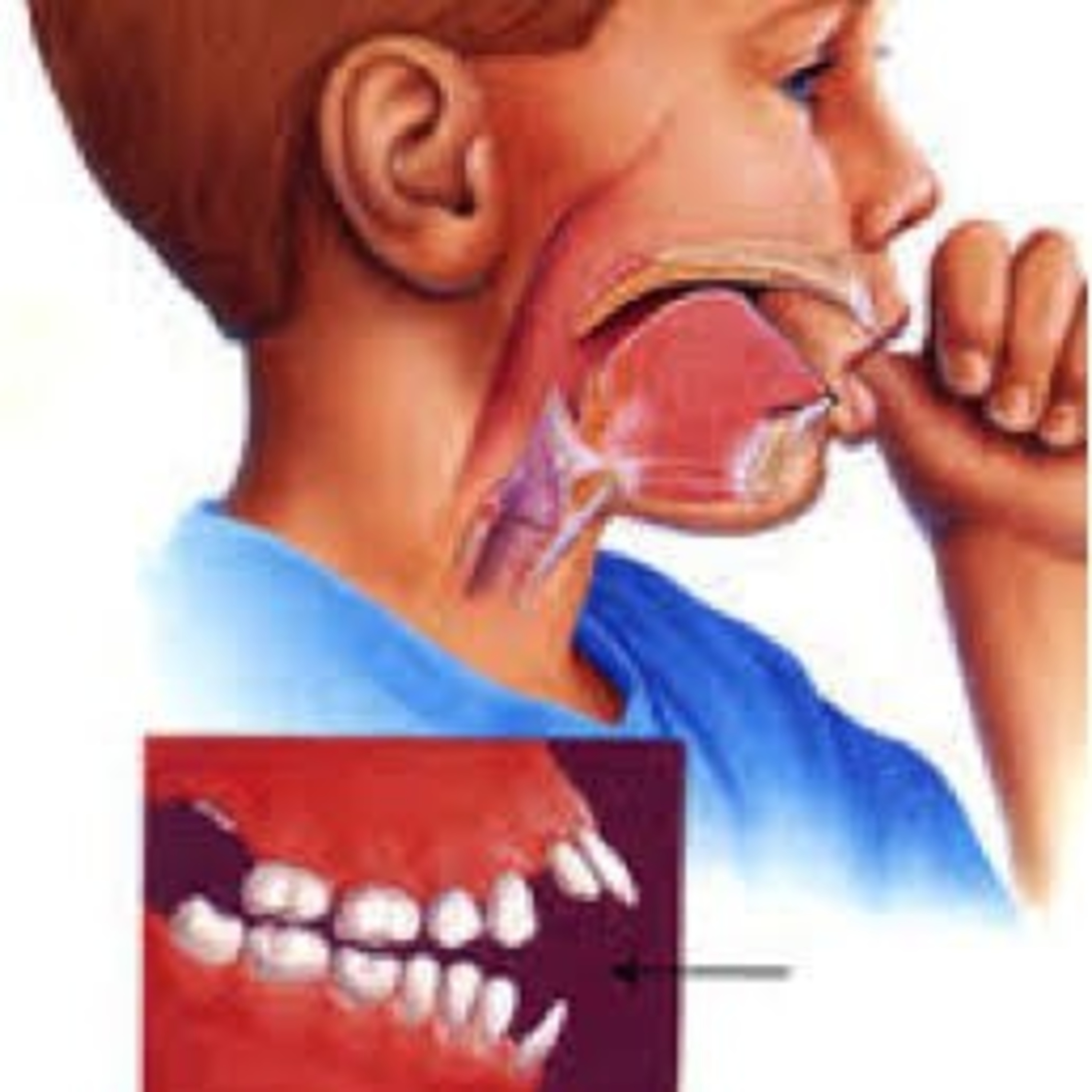 Odontopeques
