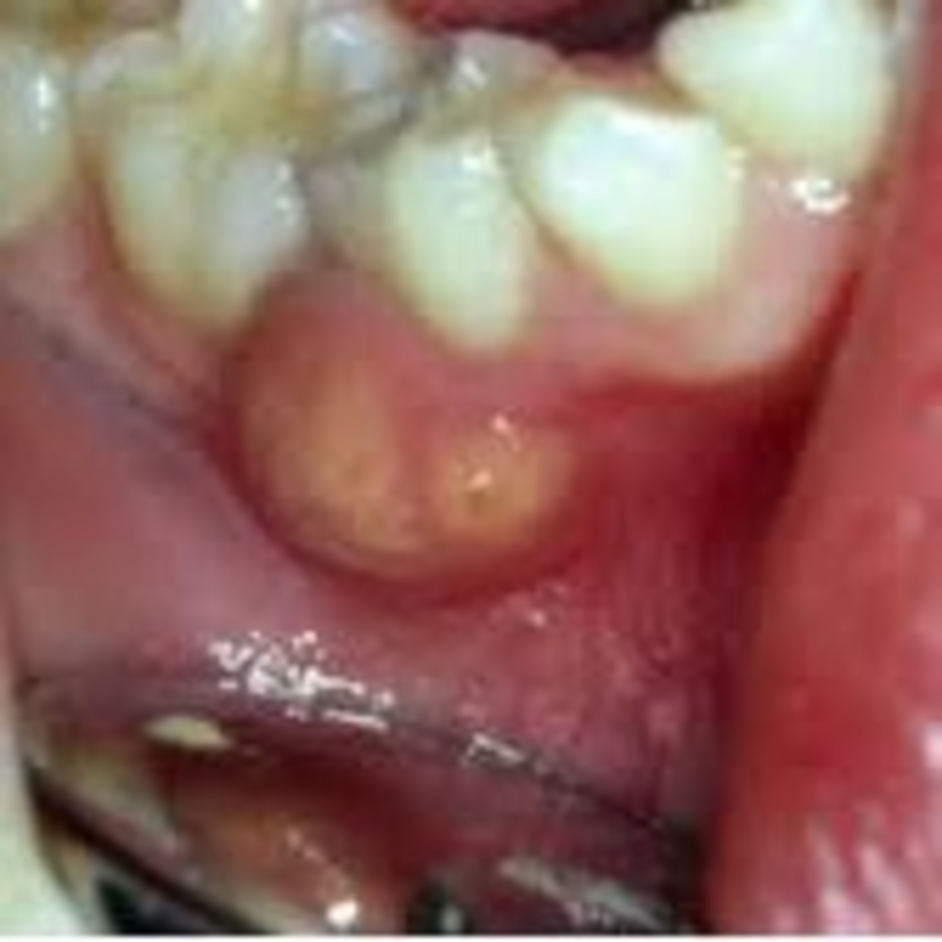 Odontopeques