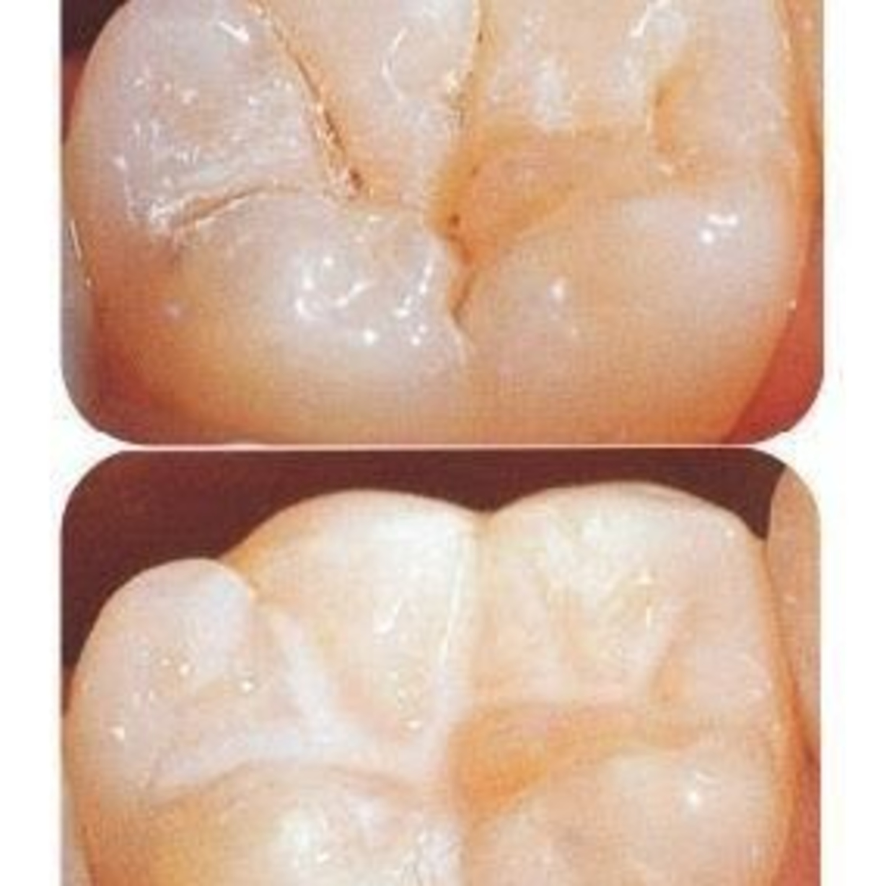Odontopeques