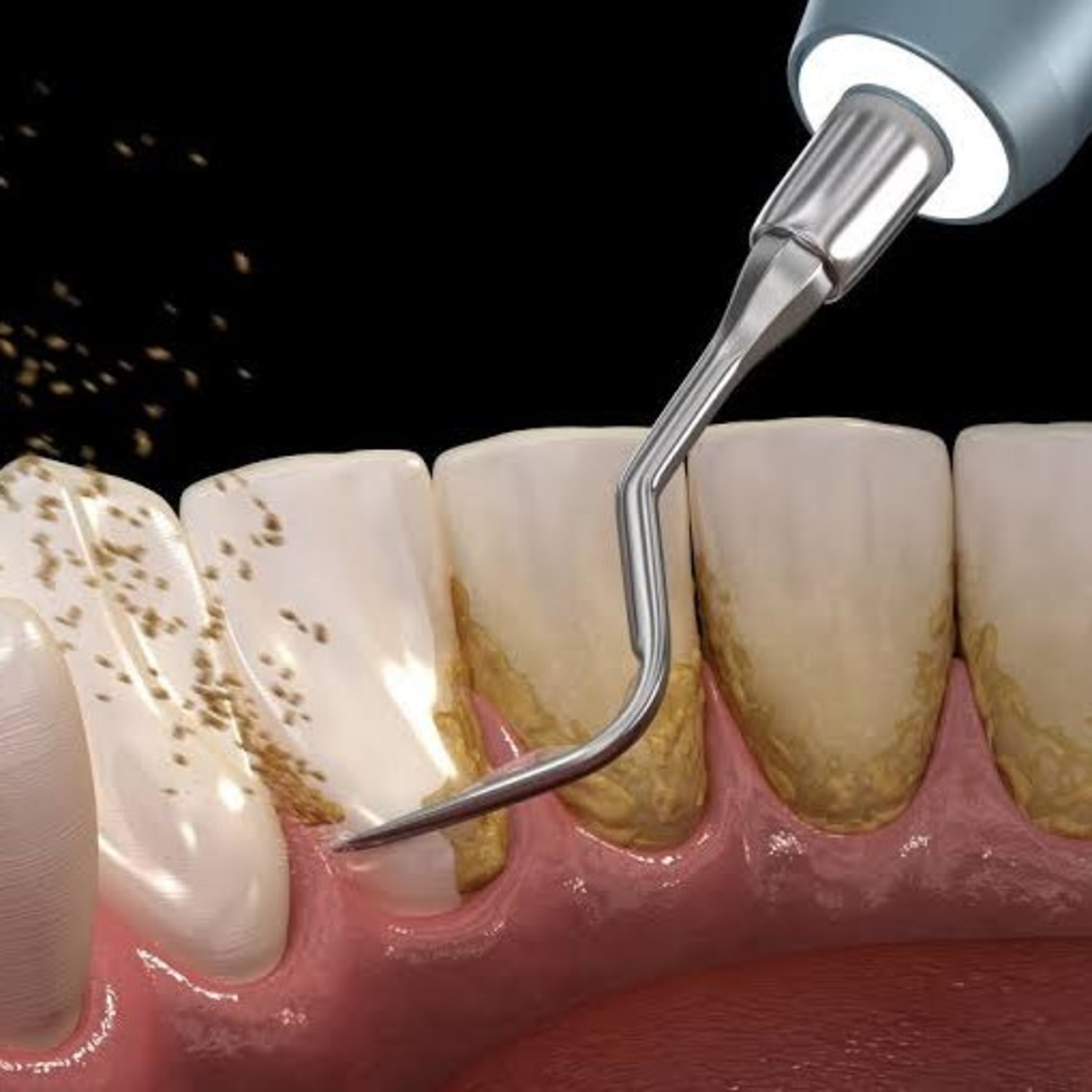 Odontopeques