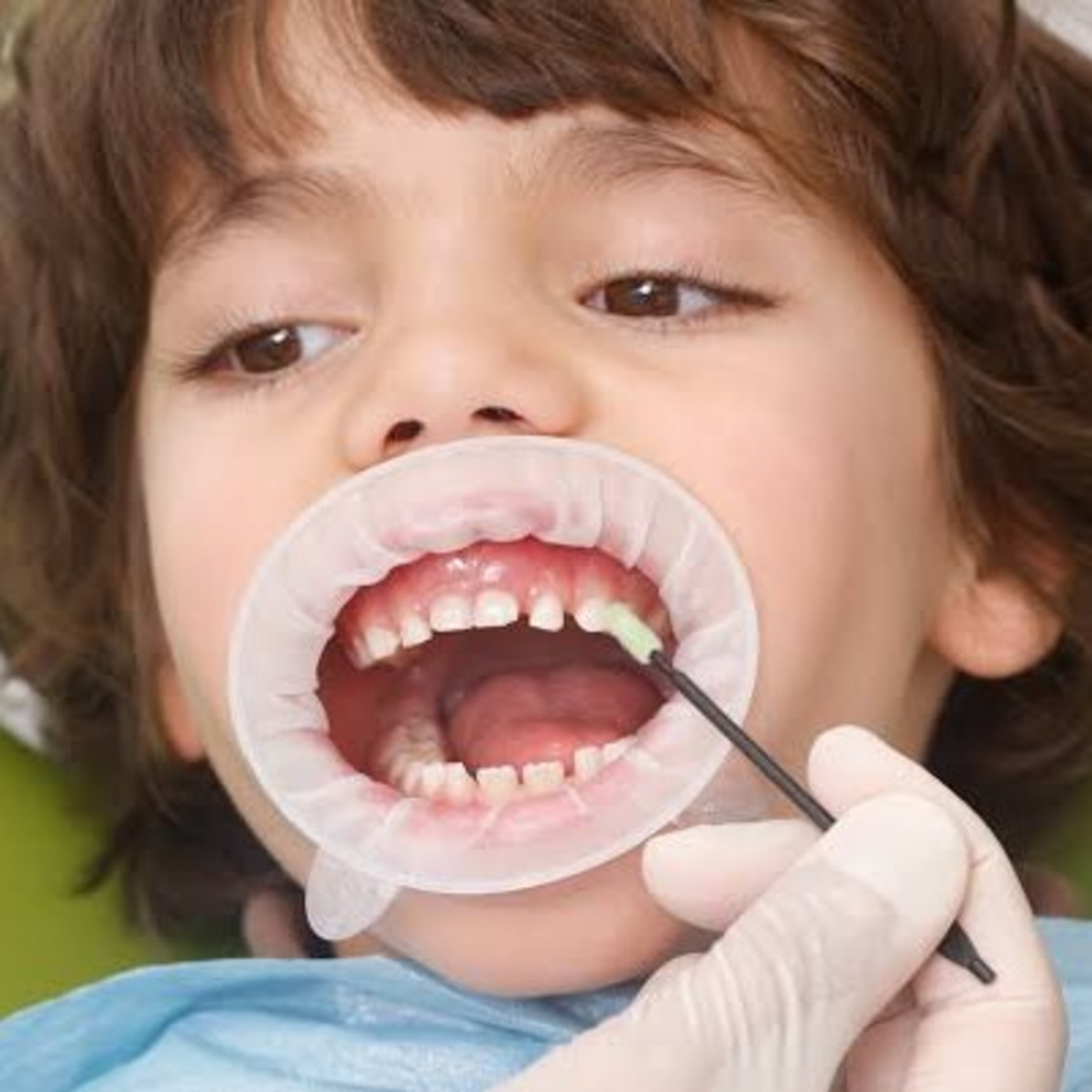 Odontopeques