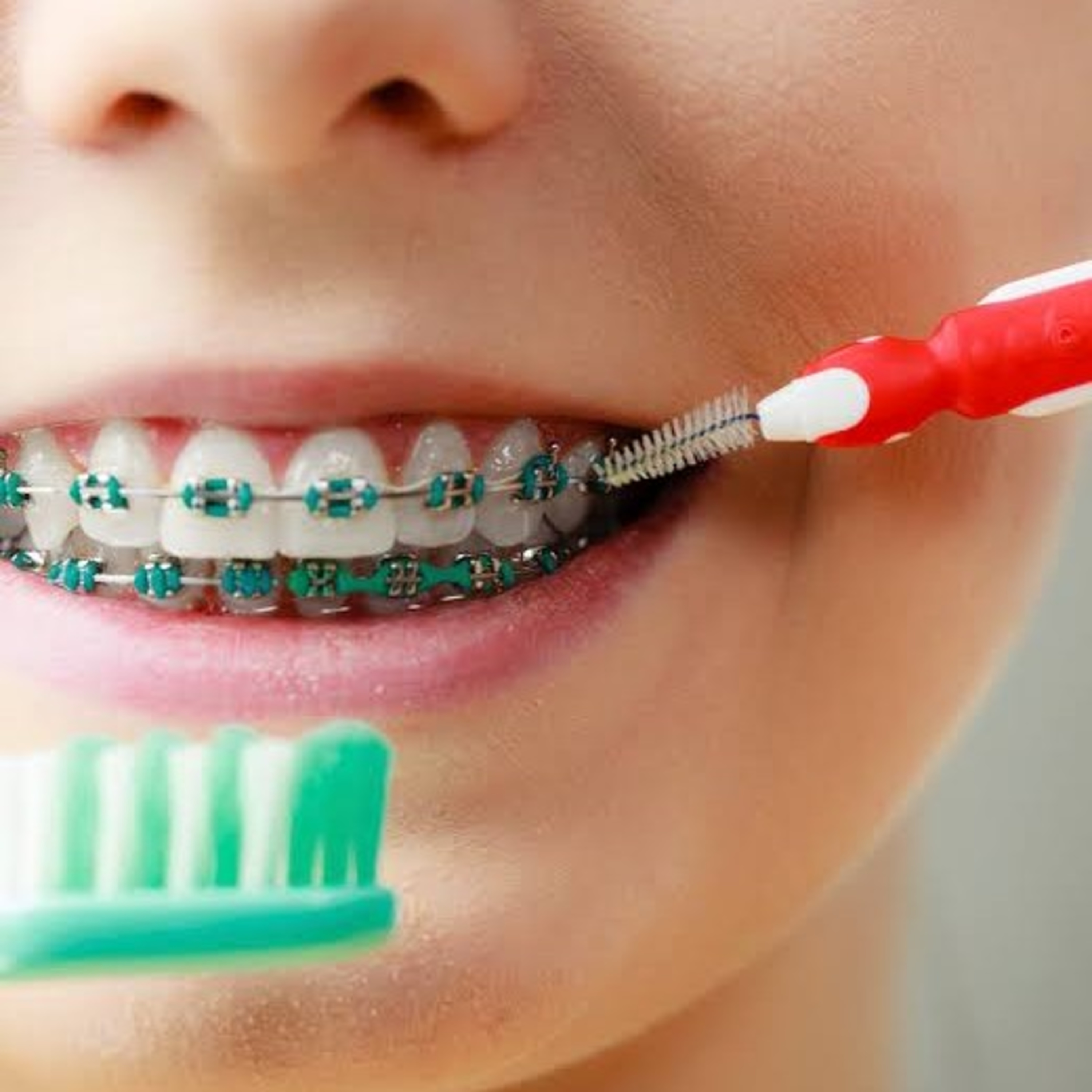 Odontopeques