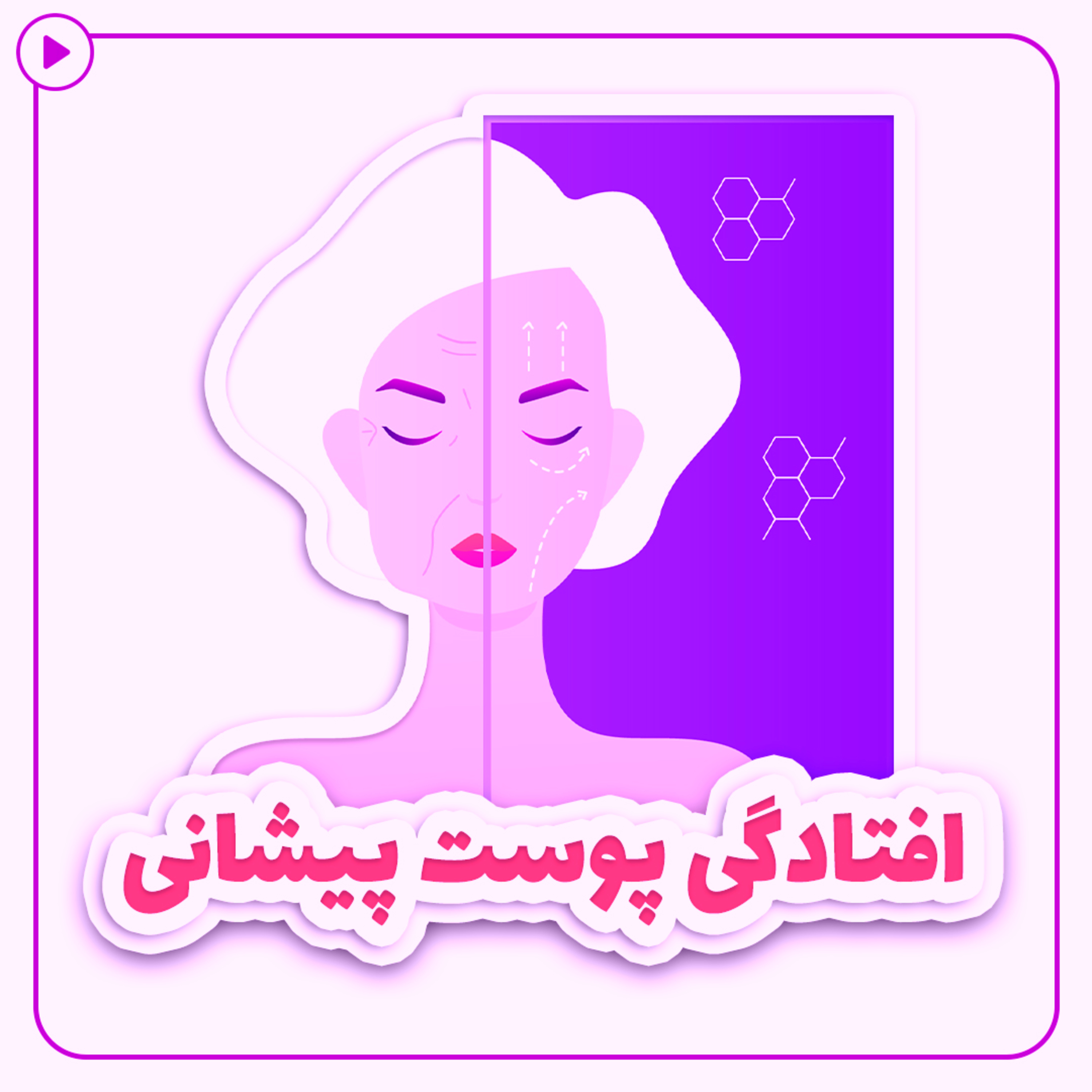 کاور افتادگی پوست پیشانی