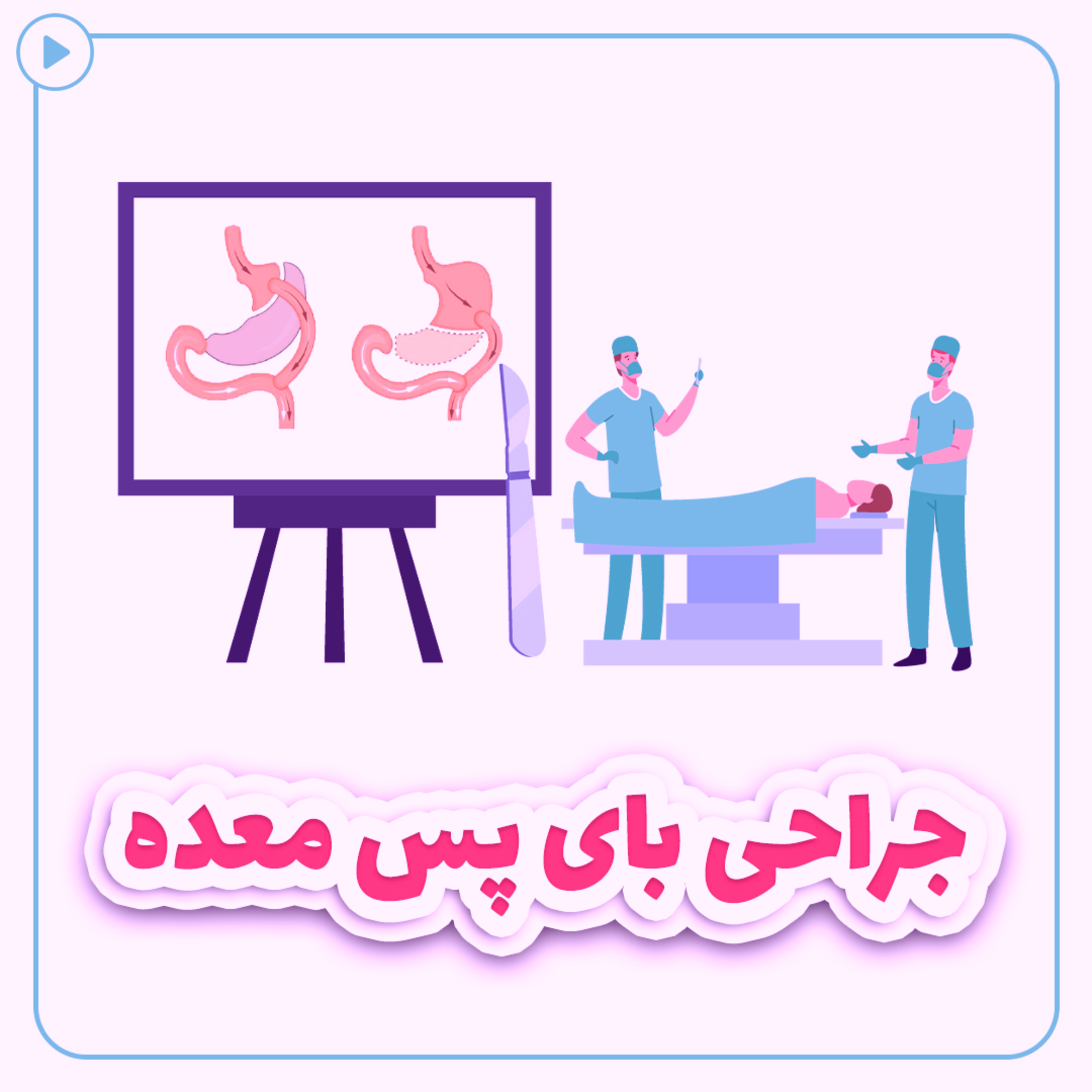 کاور بای پس معده