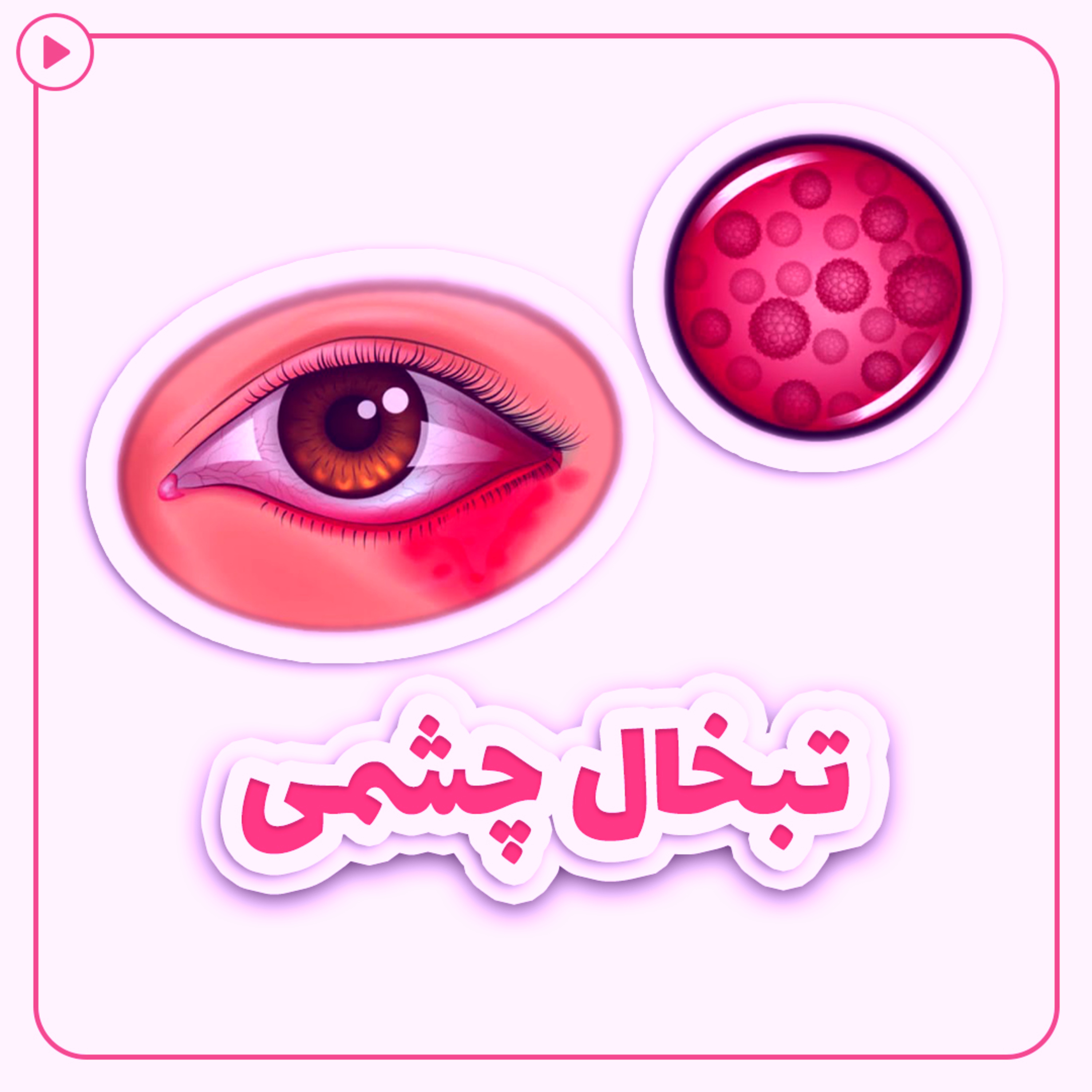 کاور تبخال چشمی
