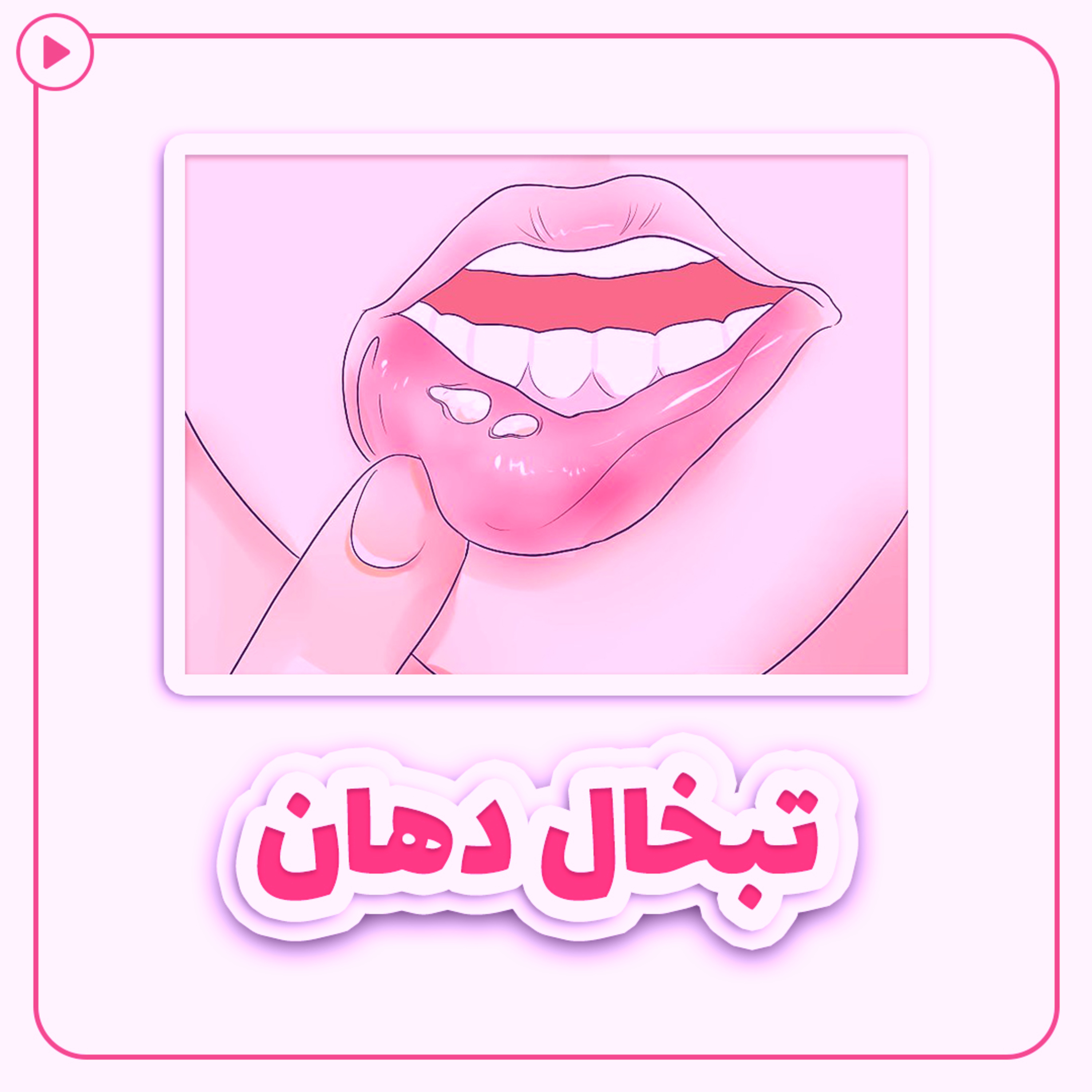 کاور تبخال دهان