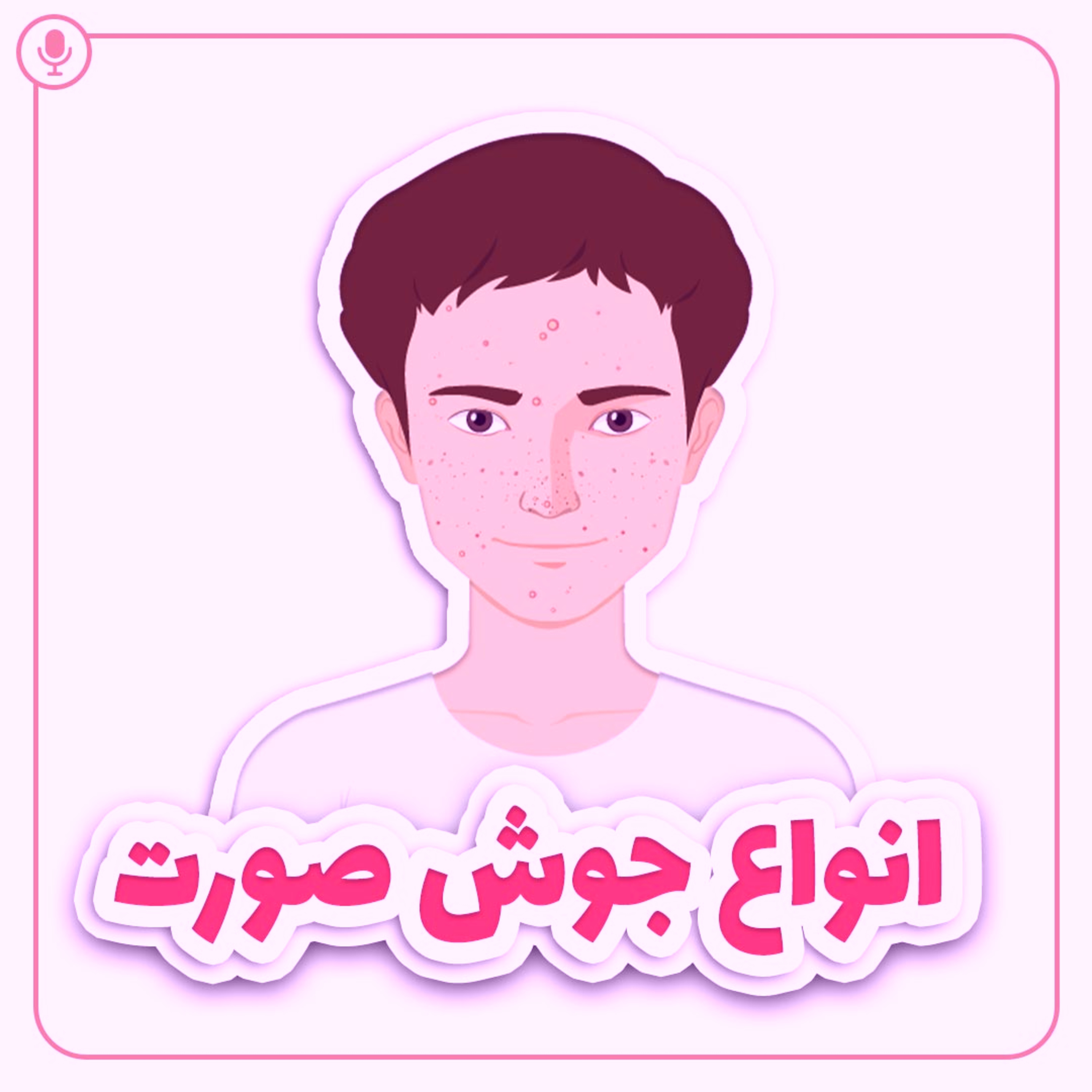 کاور انواع جوش صورت