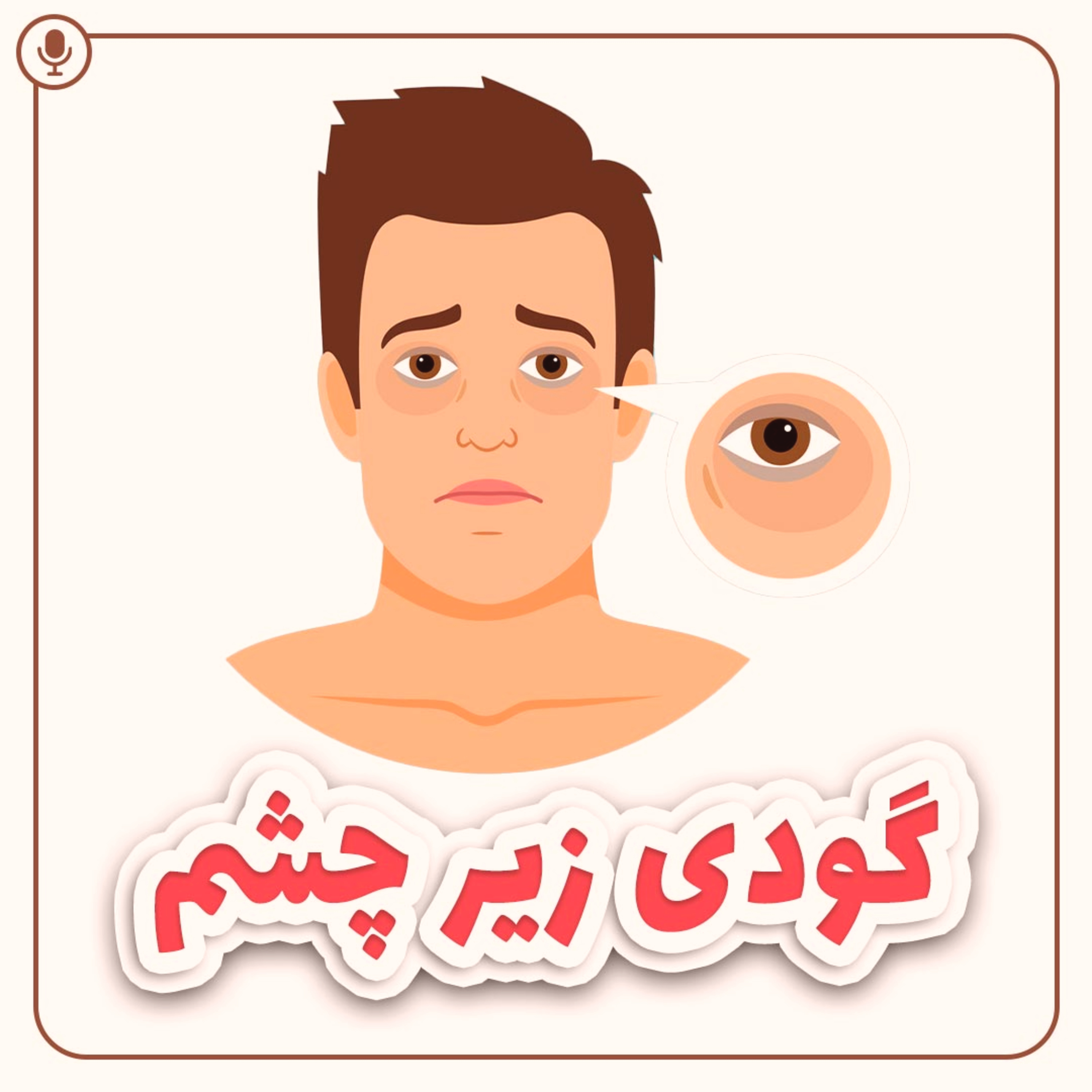 کاور گودی زیر چشم
