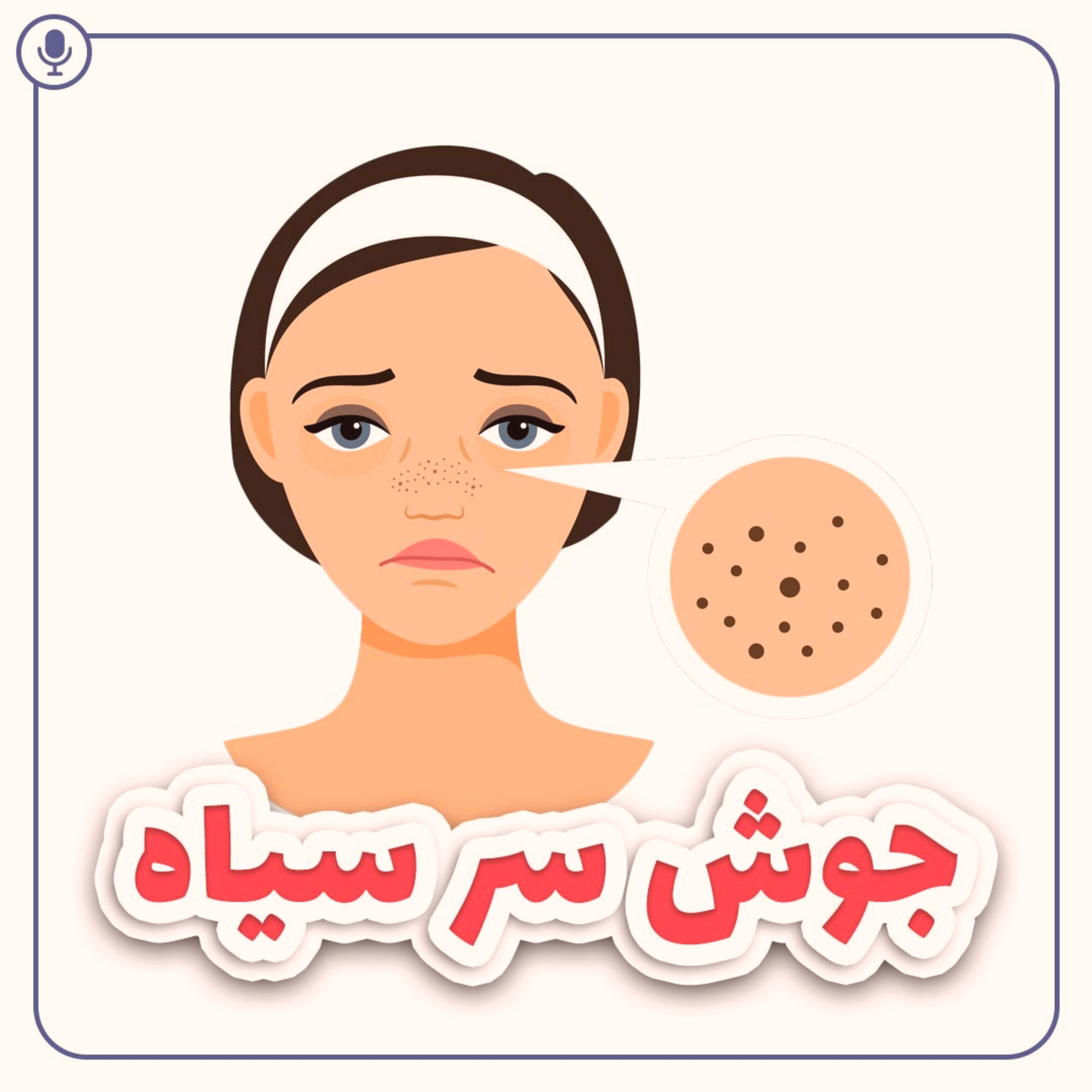 کاور جوش سر سیاه
