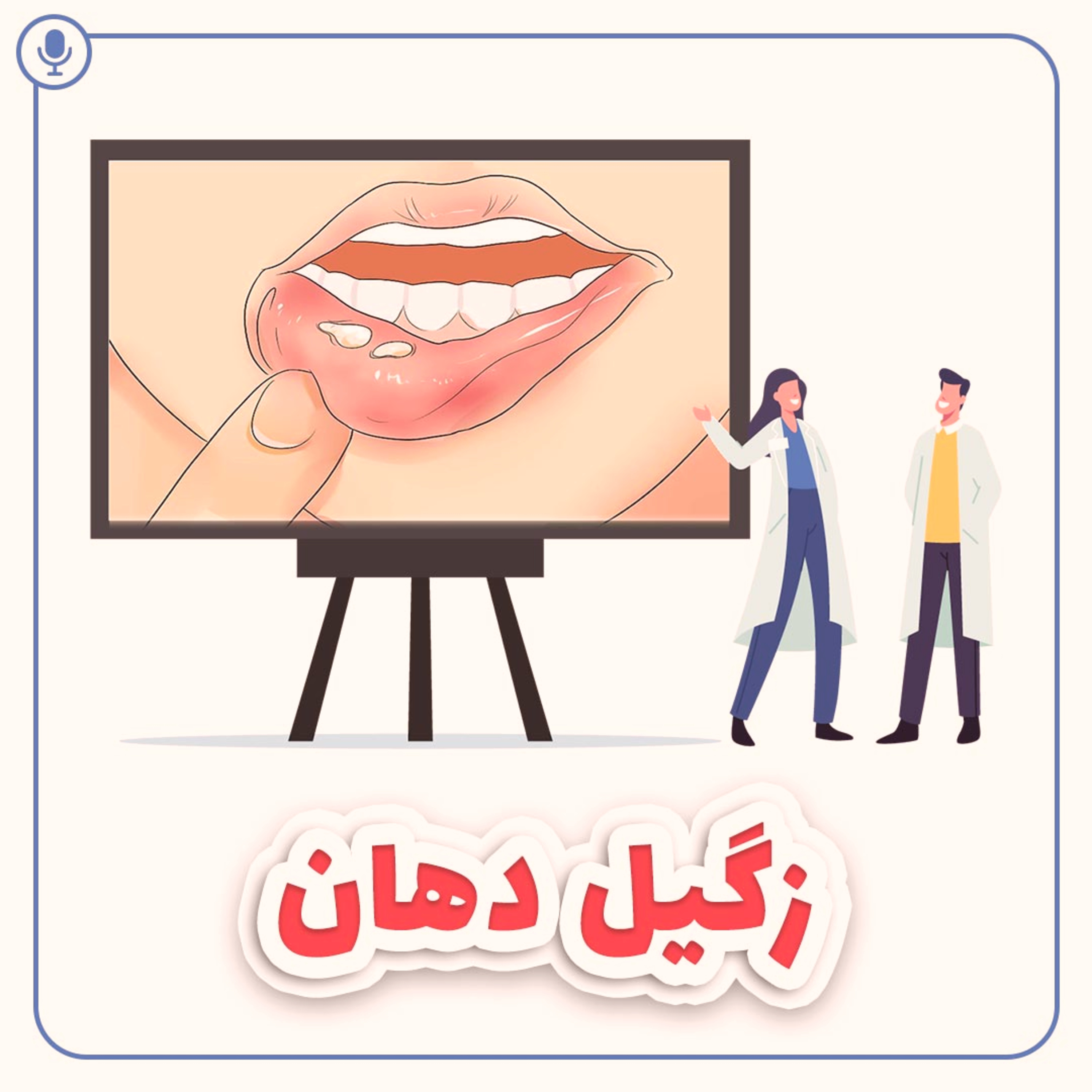 کاور زگیل دهان