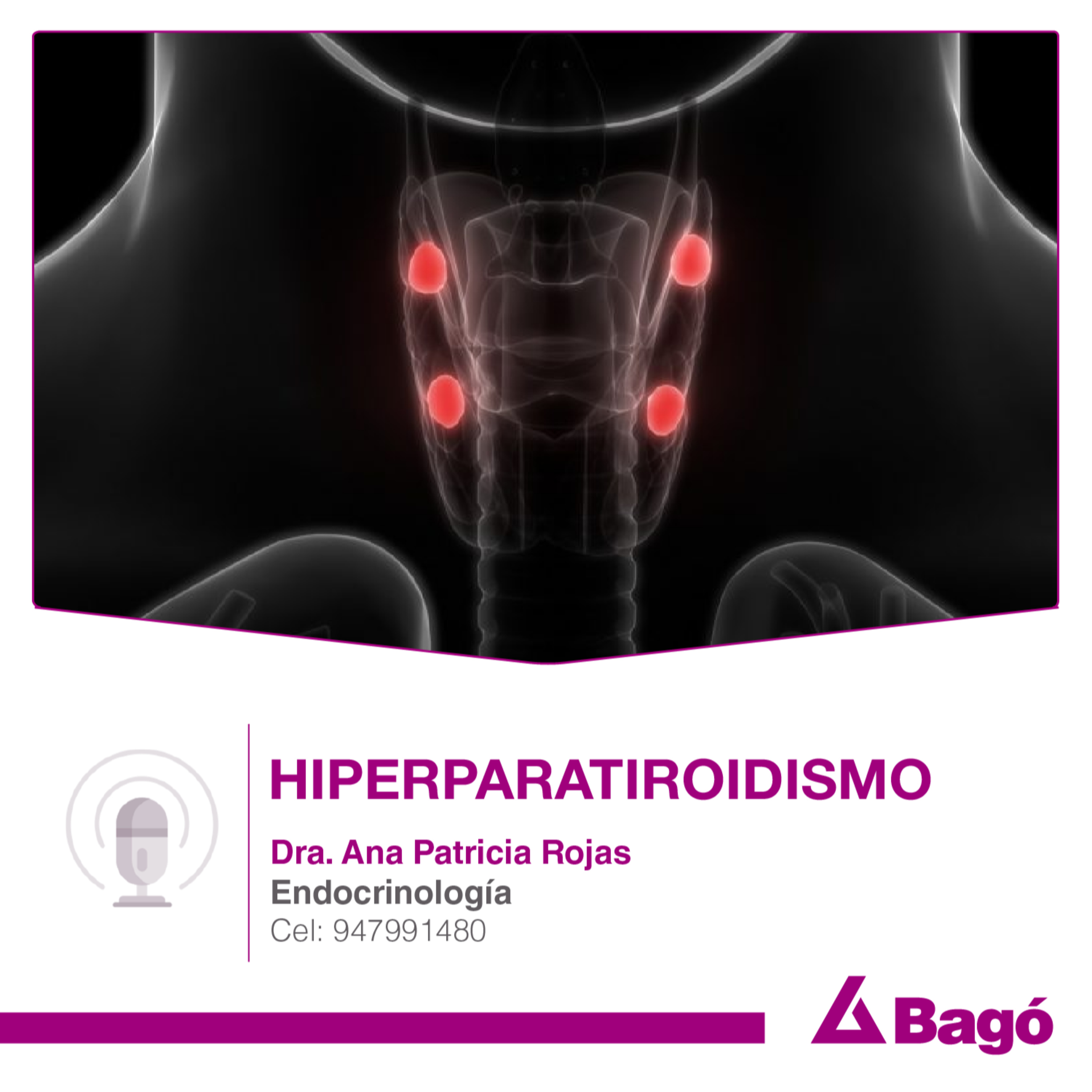 HIPERPARATIROIDISMO episode artwork