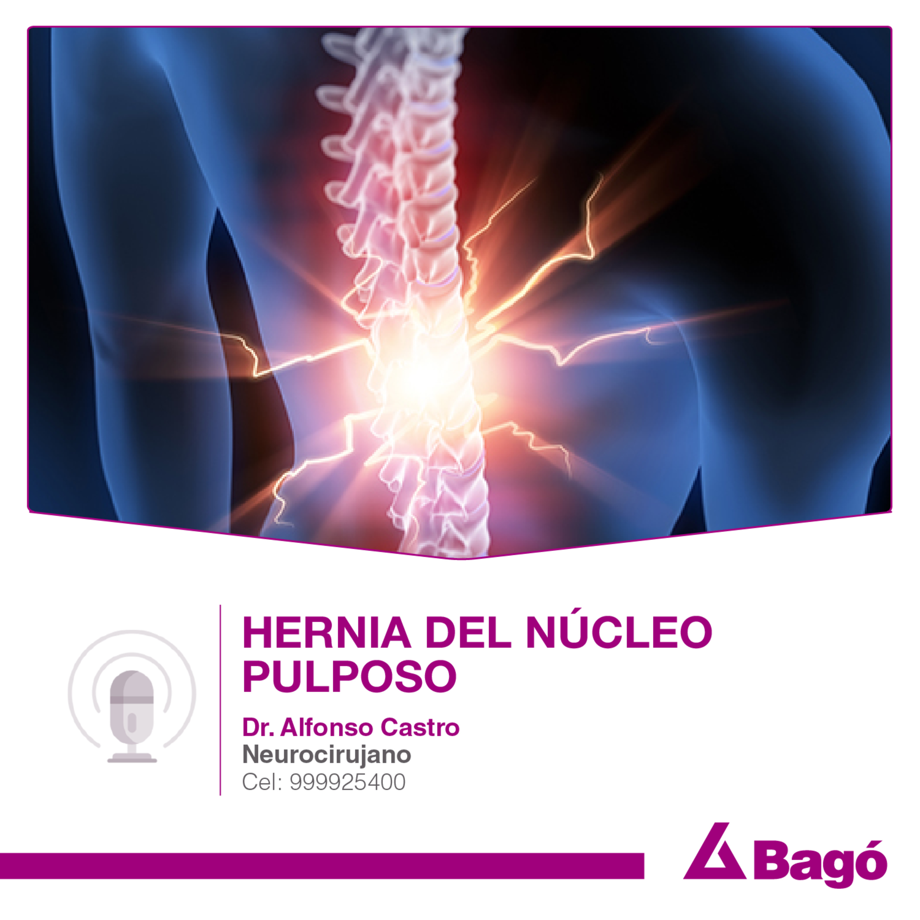 HERNIA DEL NÚCLEO PULPOSO episode artwork